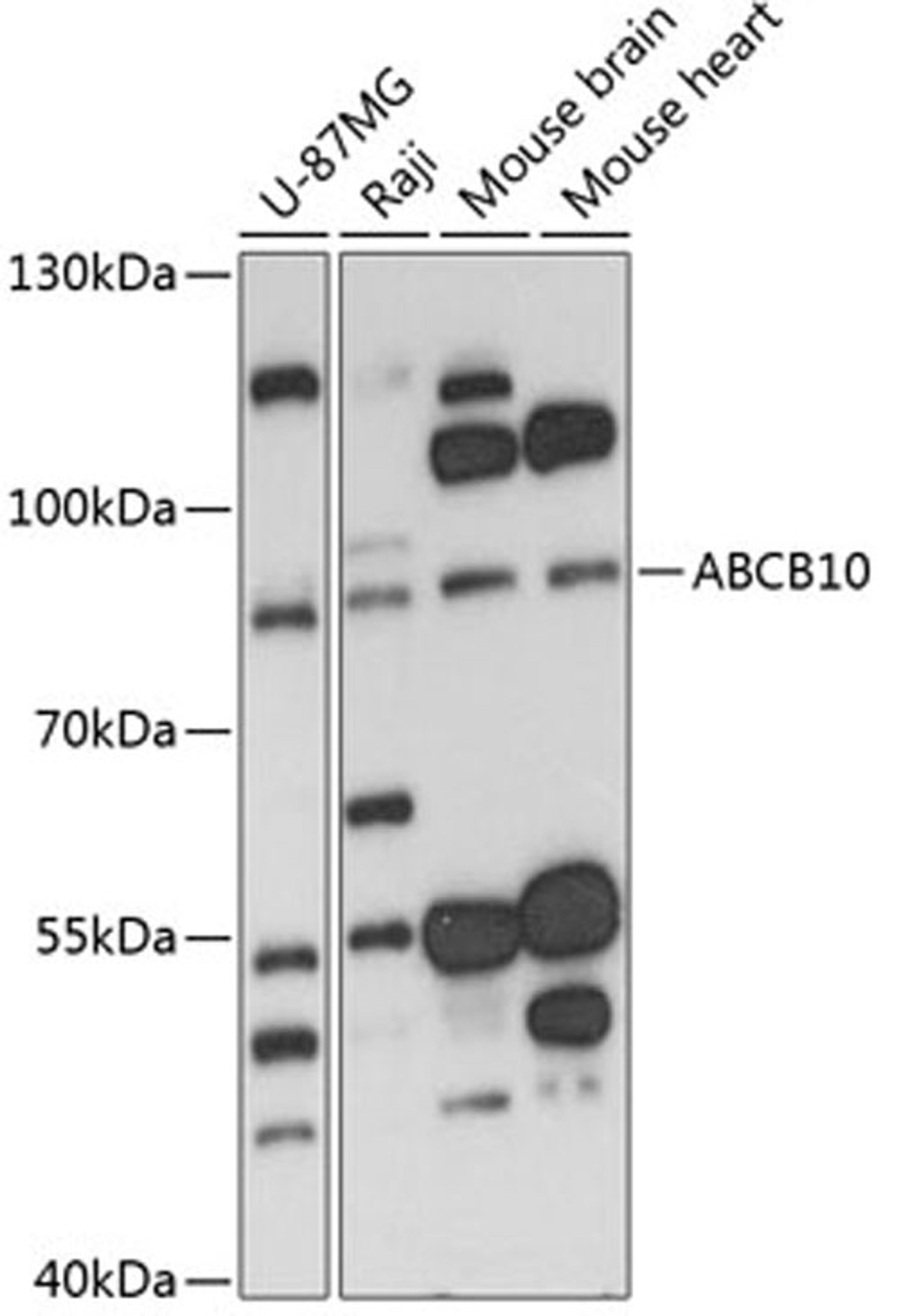 Western blot - ABCB10 antibody (A13787)