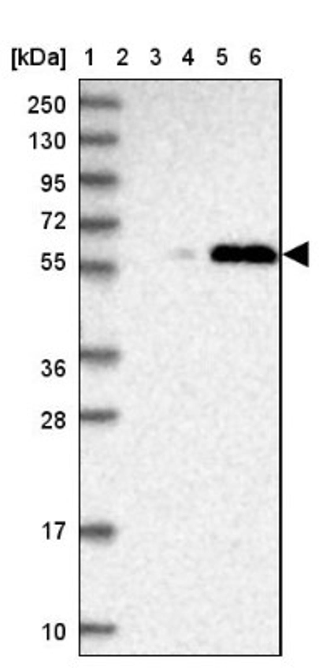 Western Blot: TRMT2B Antibody [NBP2-38475] - Lane 1: Marker [kDa] 250, 130, 95, 72, 55, 36, 28, 17, 10<br/>Lane 2: RT-4<br/>Lane 3: U-251 MG<br/>Lane 4: Human Plasma<br/>Lane 5: Liver<br/>Lane 6: Tonsil