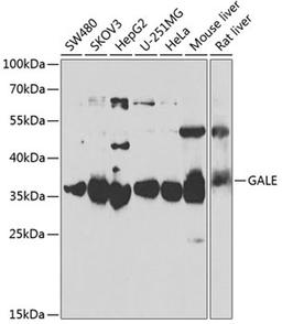 Western blot - GALE antibody (A6595)