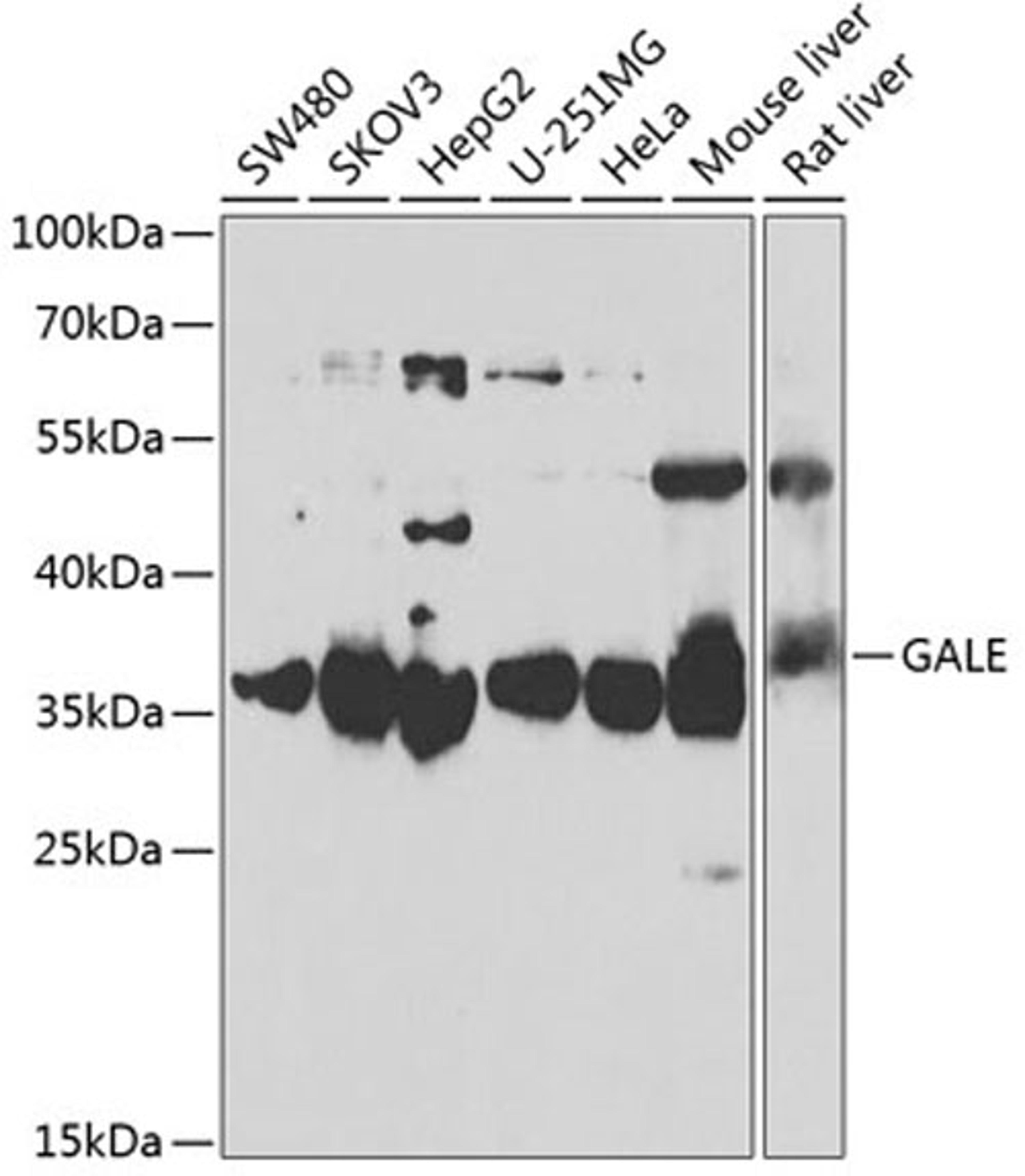 Western blot - GALE antibody (A6595)