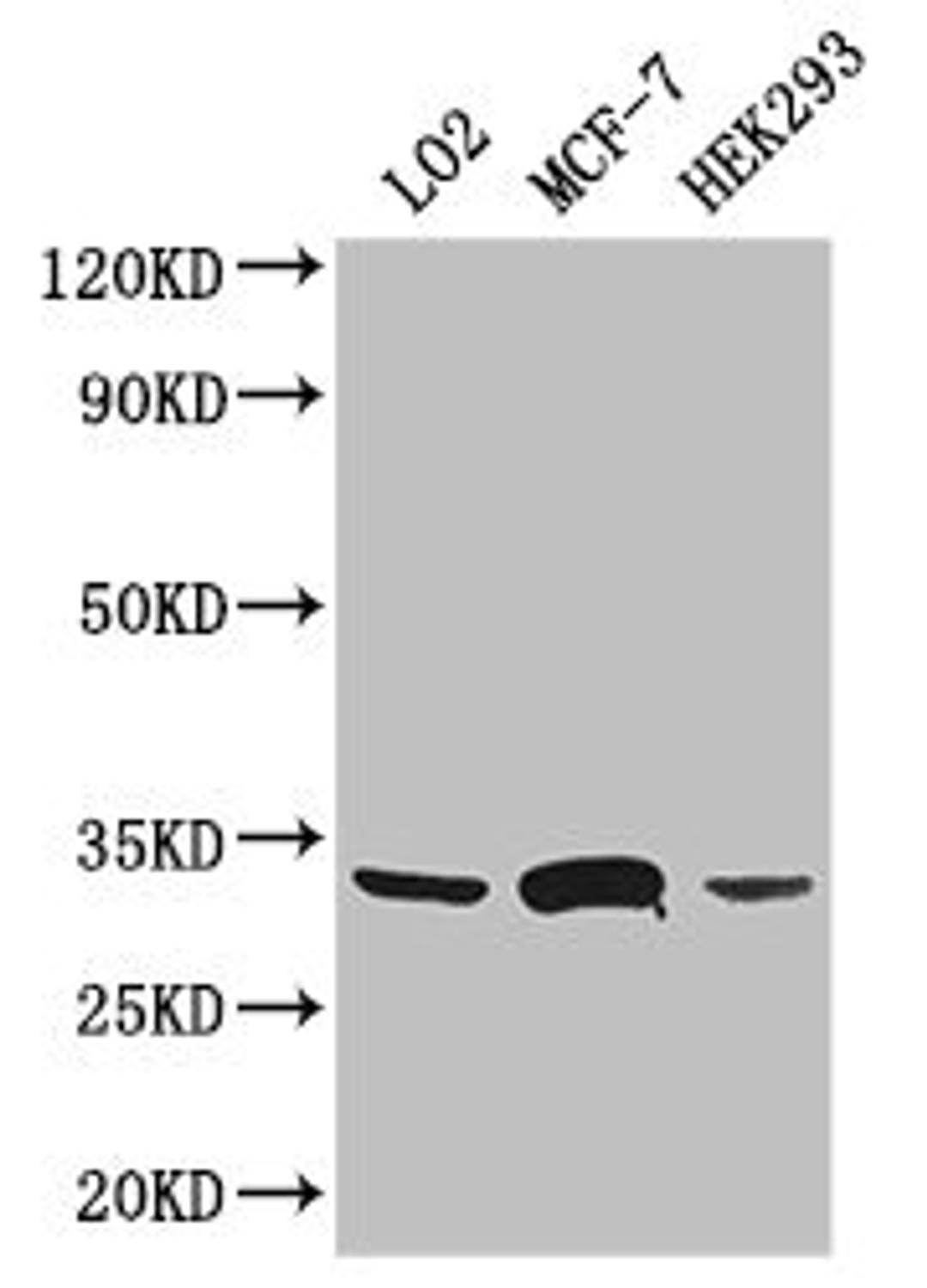 Western Blot. Positive WB detected in: LO2 whole cell lysate, MCF-7 whole cell lysate, HEK293 whole cell lysate. All lanes: SLC25A6 antibody at 3ug/ml. Secondary. Goat polyclonal to rabbit IgG at 1/50000 dilution. Predicted band size: 33 kDa. Observed band size: 33 kDa.