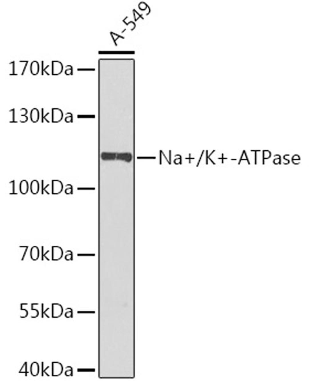 Western blot - Na+/K+-ATPase antibody (A7878)