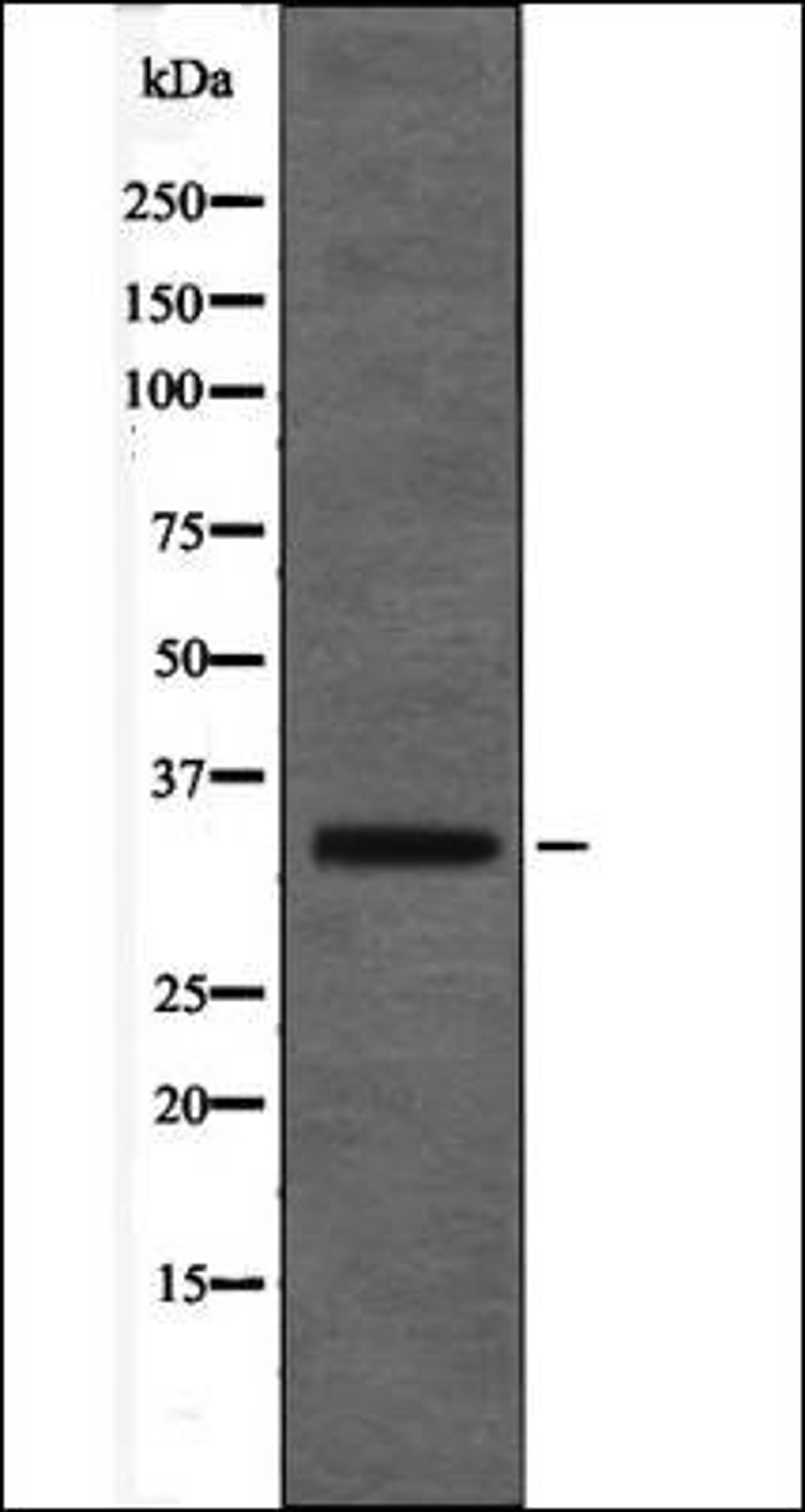 Western blot analysis of COS7 whole cell lysates using MAX -Phospho-Ser2- antibody