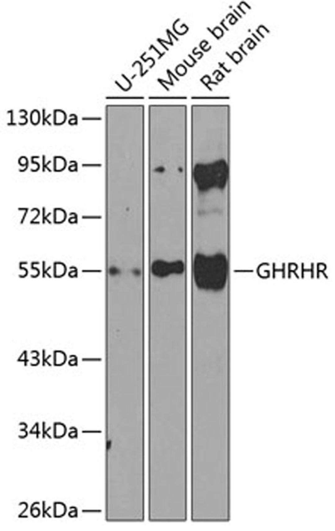 Western blot - GHRHR antibody (A8421)