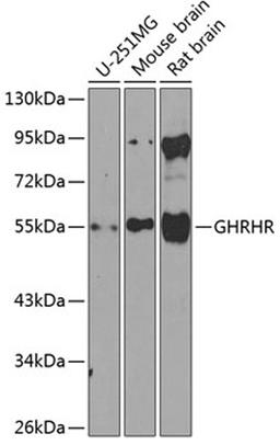 Western blot - GHRHR antibody (A8421)