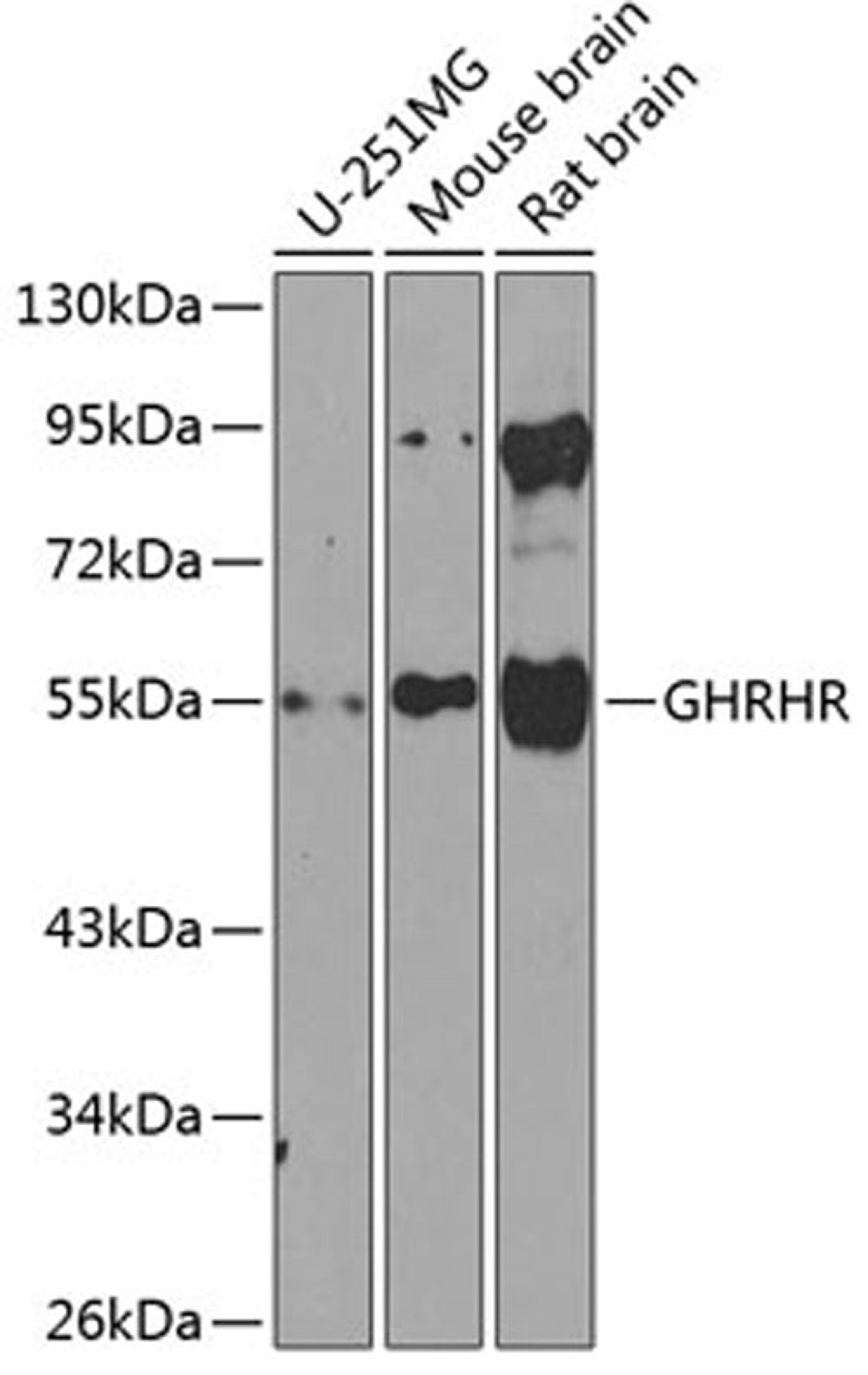 Western blot - GHRHR antibody (A8421)