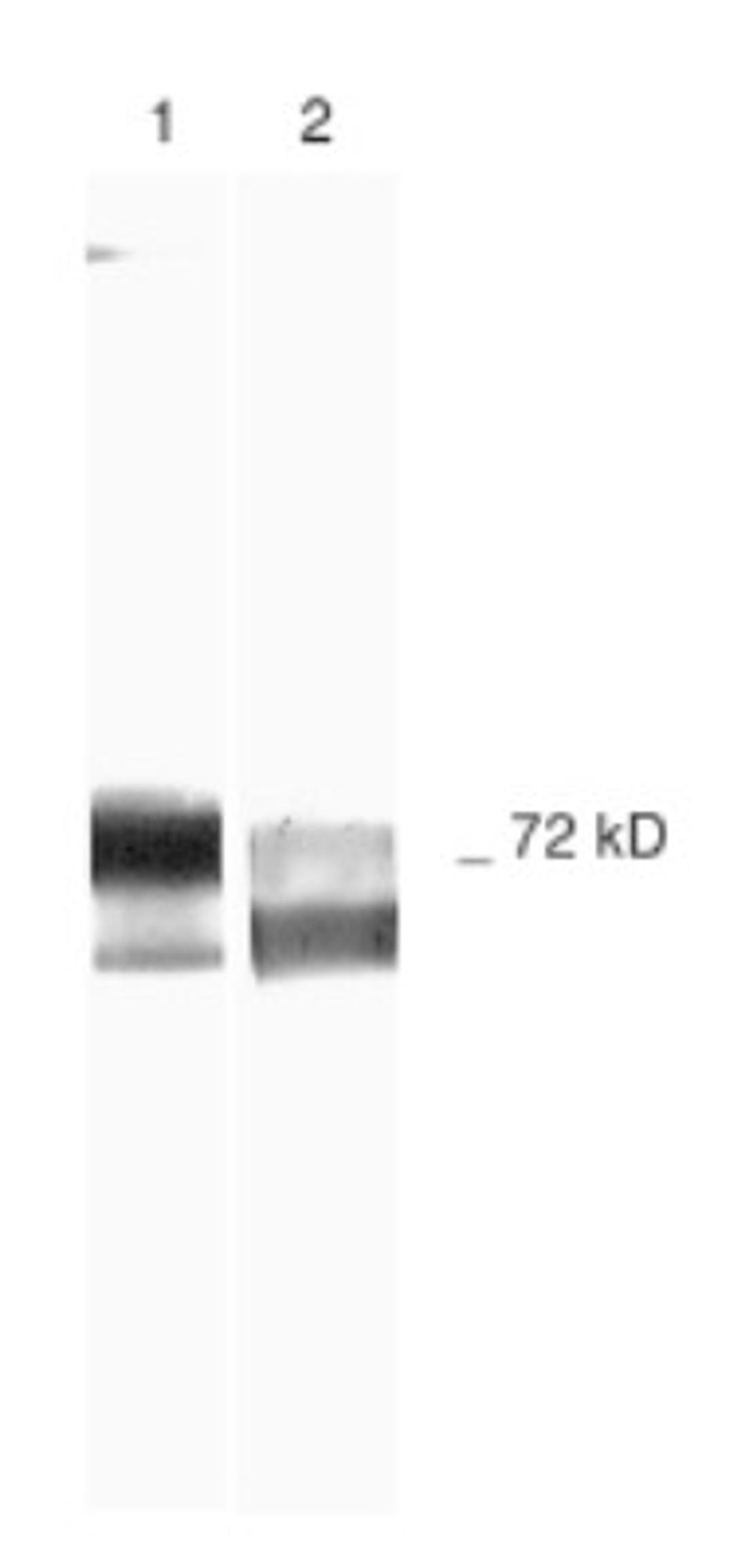 Western Blot: MMP2 Antibody (2C1) [NB200-113] - Samples: Lane 1 - Human Recombinant MMP-2. Lane 2 - Schwann Cell Culture Medium Run on 10% SDS-PAGE, followed by electroblot to nitrocellulose and slot blot immunolabeling. Antibodies: primary - NB 200-113, secondary - anti-mouse-biotin. Detection: avidin-HRP. Chromagen: DAB/H202.