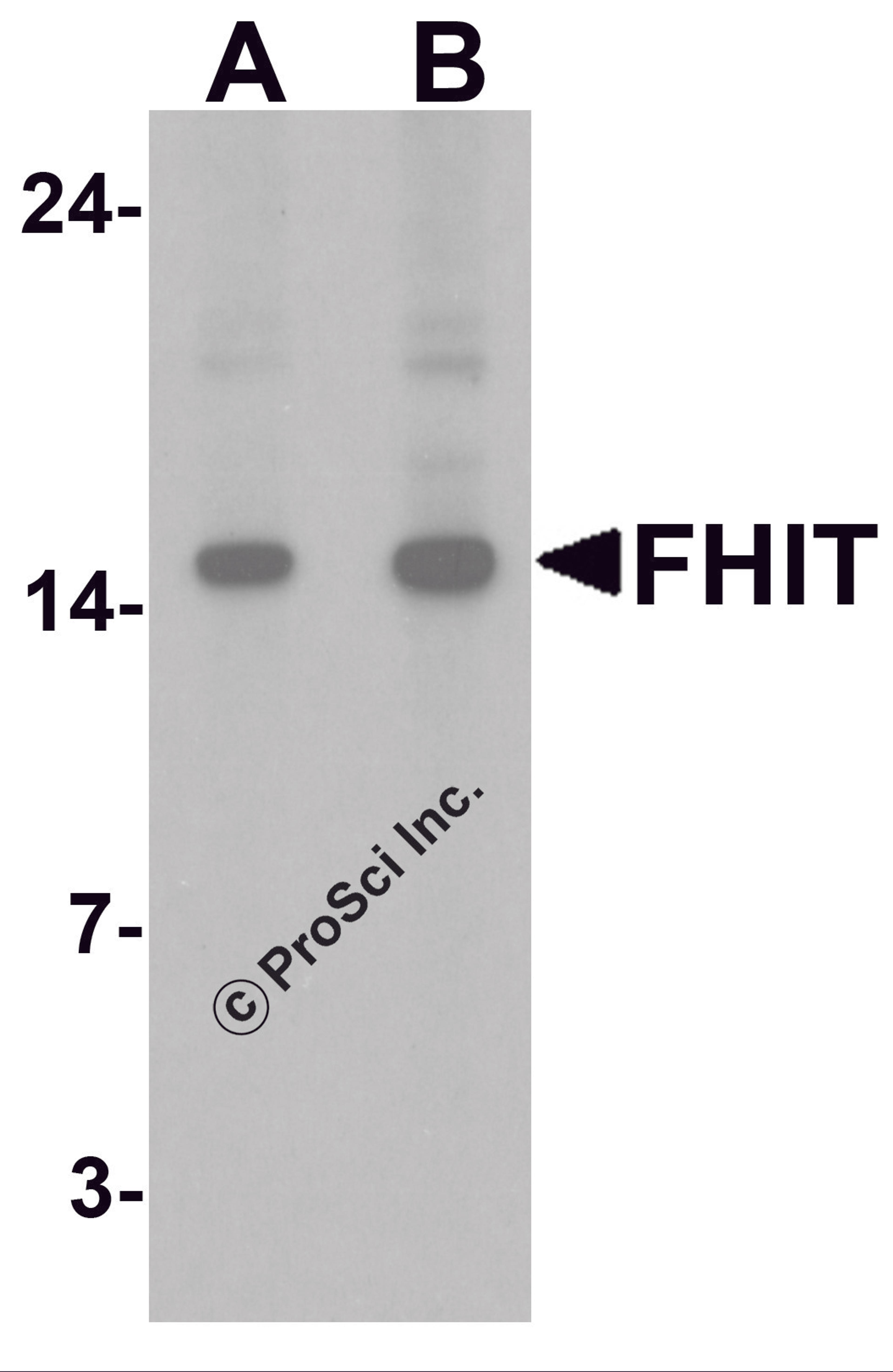 Western blot analysis of FHIT in HeLa cell lysate with FHIT antibody at (A) 1 and (B) 2 &#956;g/ml.