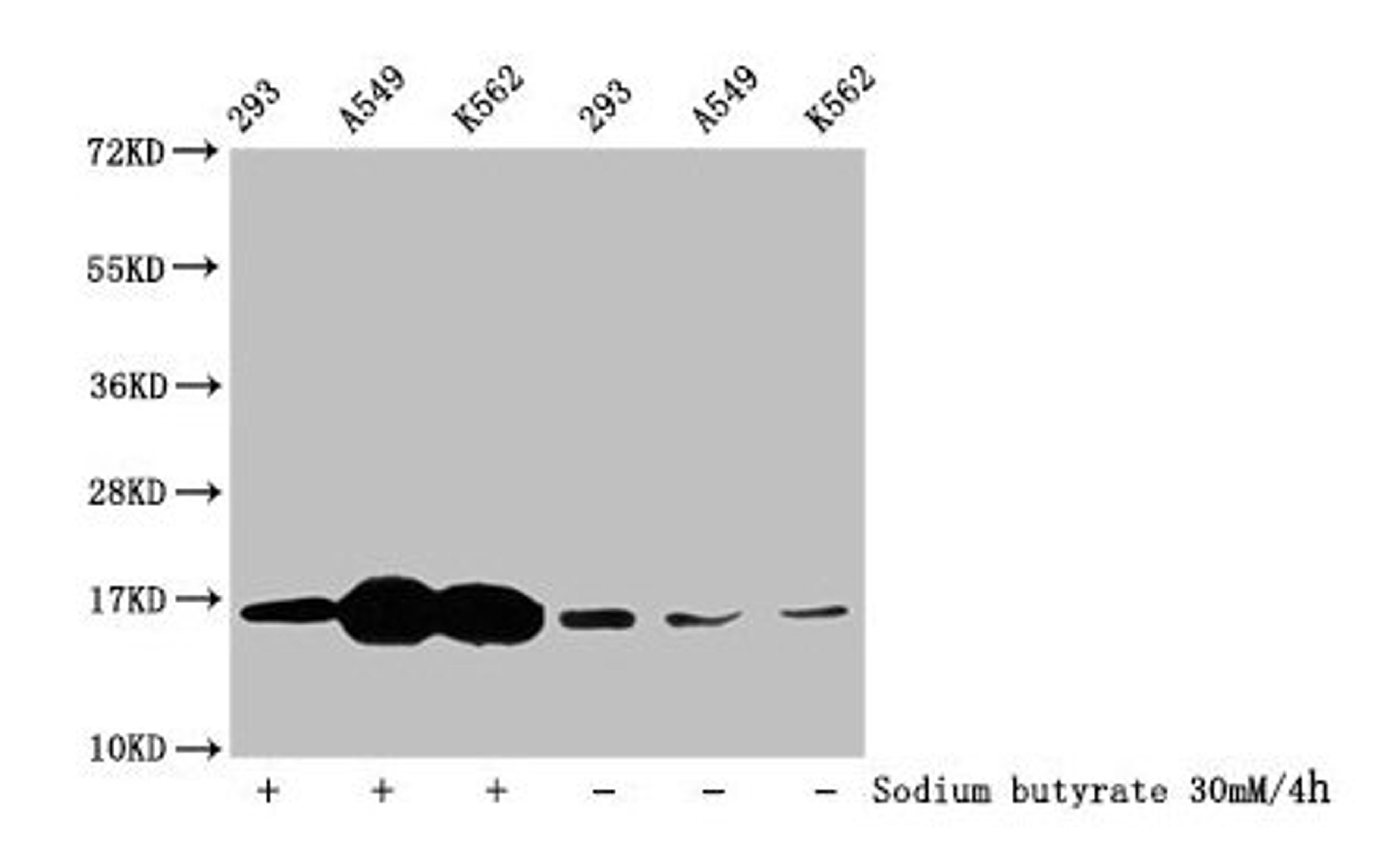 Western Blot. Detected samples: 293 whole cell lysate, A549 whole cell lysate, K562 whole cell lysate; Untreated (-) or treated (+) with 30mM sodium butyrate for 4h. All lanes: HIST1H3A antibody at 1:100. Secondary. Goat polyclonal to rabbit IgG at 1/50000 dilution. Predicted band size: 16 kDa. Observed band size: 16 kDa