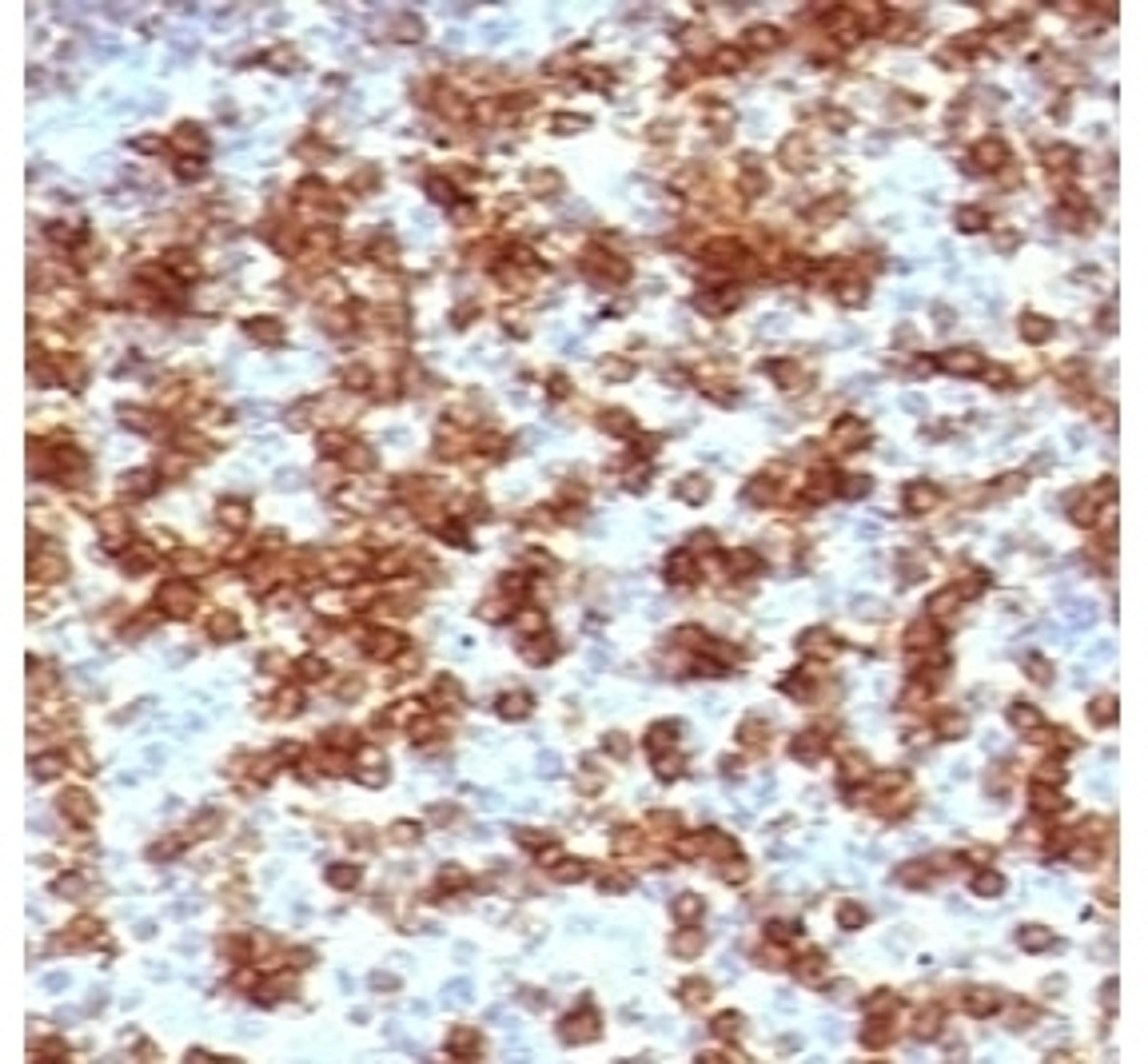 IHC testing of FFPE human tonsil stained with anti-PD-1 antibody (clone PD203-1).