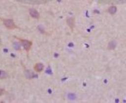 Immunohistochemical staining of rat brain tissue using LLGL1 (phospho-Ser650-654) antibody.