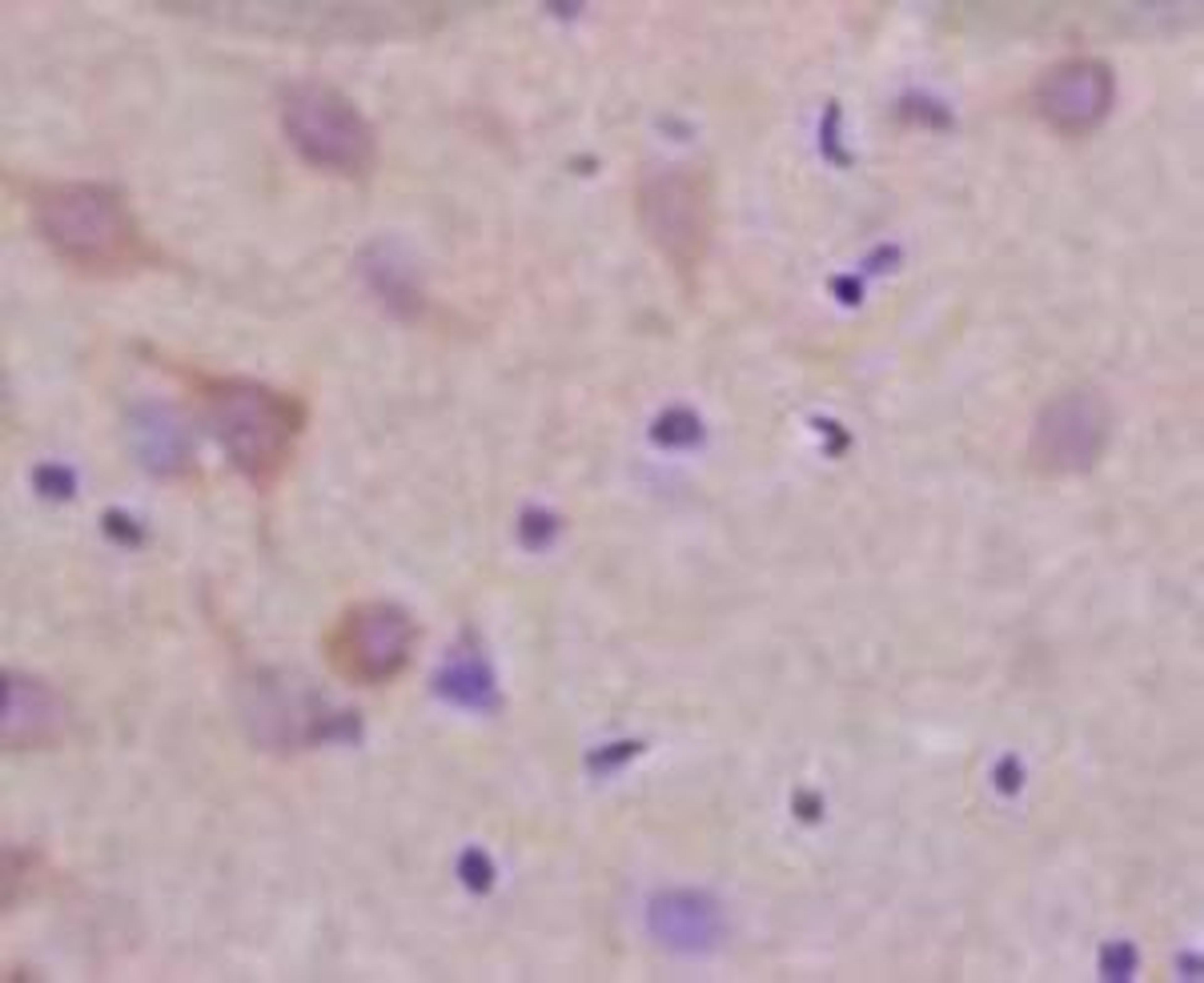 Immunohistochemical staining of rat brain tissue using LLGL1 (phospho-Ser650-654) antibody.