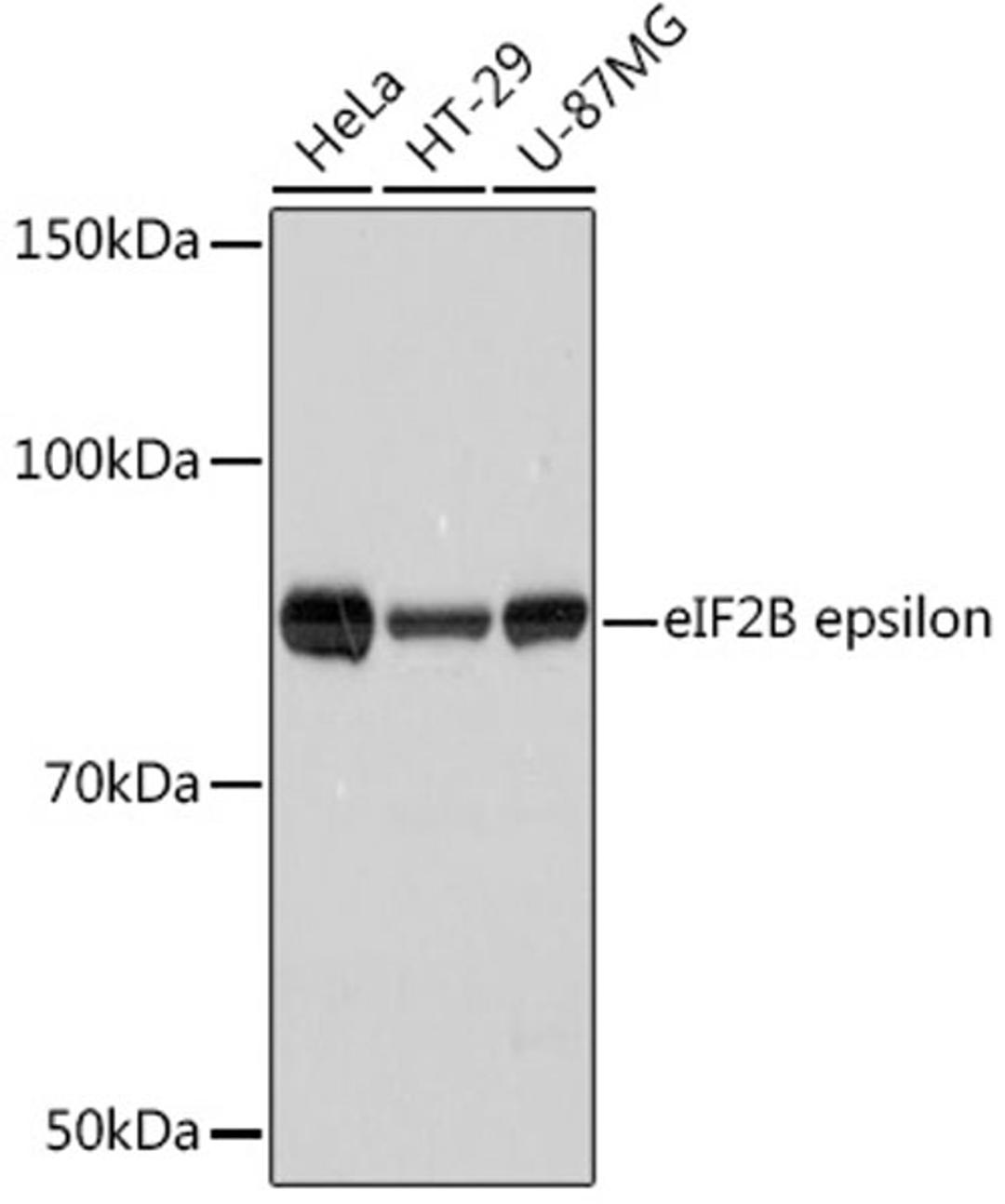 Western blot - eIF2B epsilon Rabbit mAb (A8670)