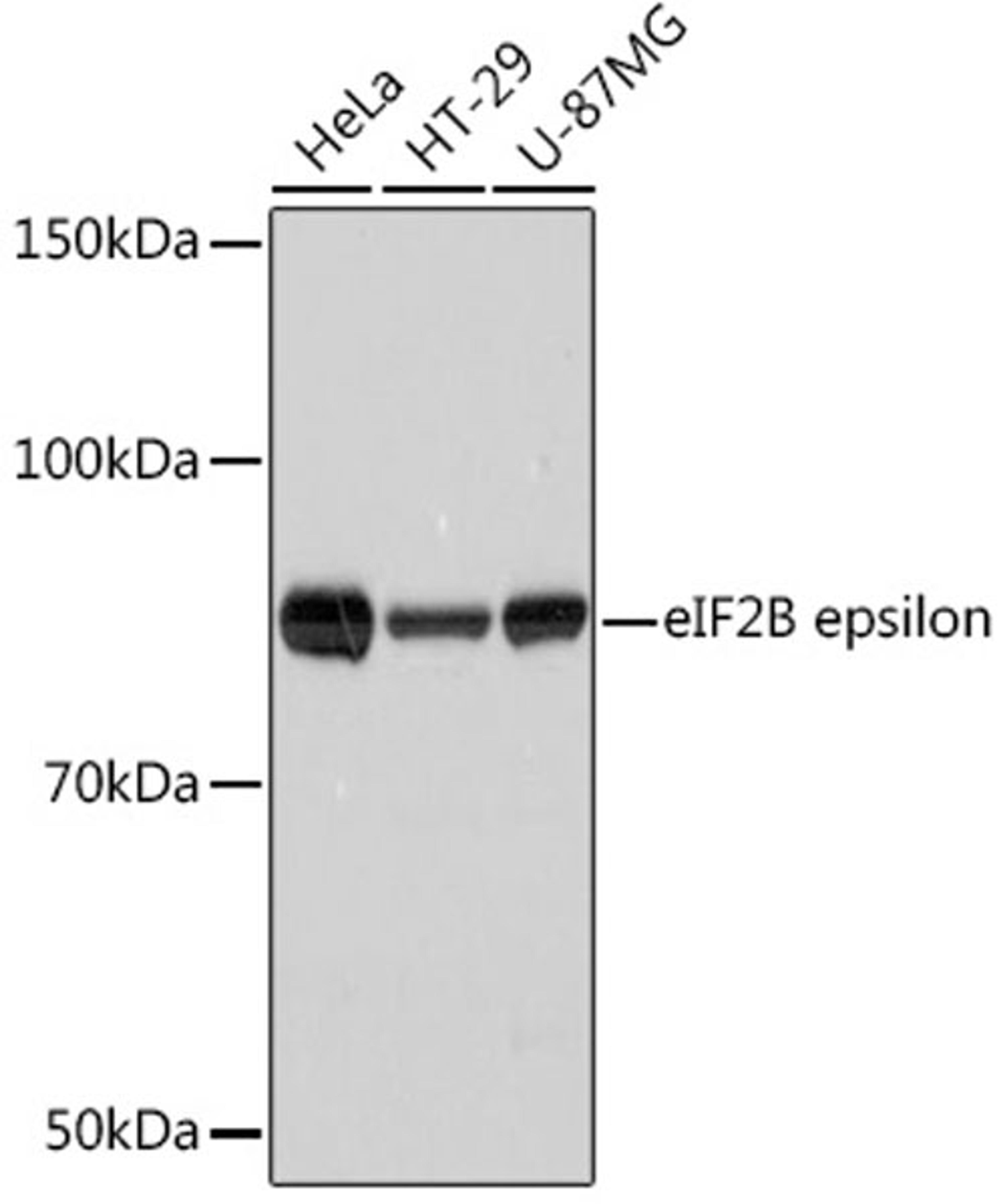 Western blot - eIF2B epsilon Rabbit mAb (A8670)