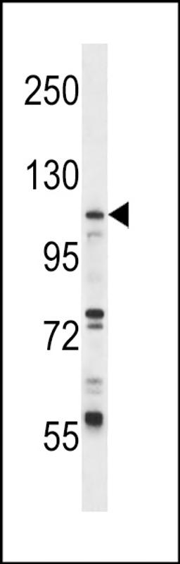 Western blot analysis in CEM cell line lysates (35ug/lane).