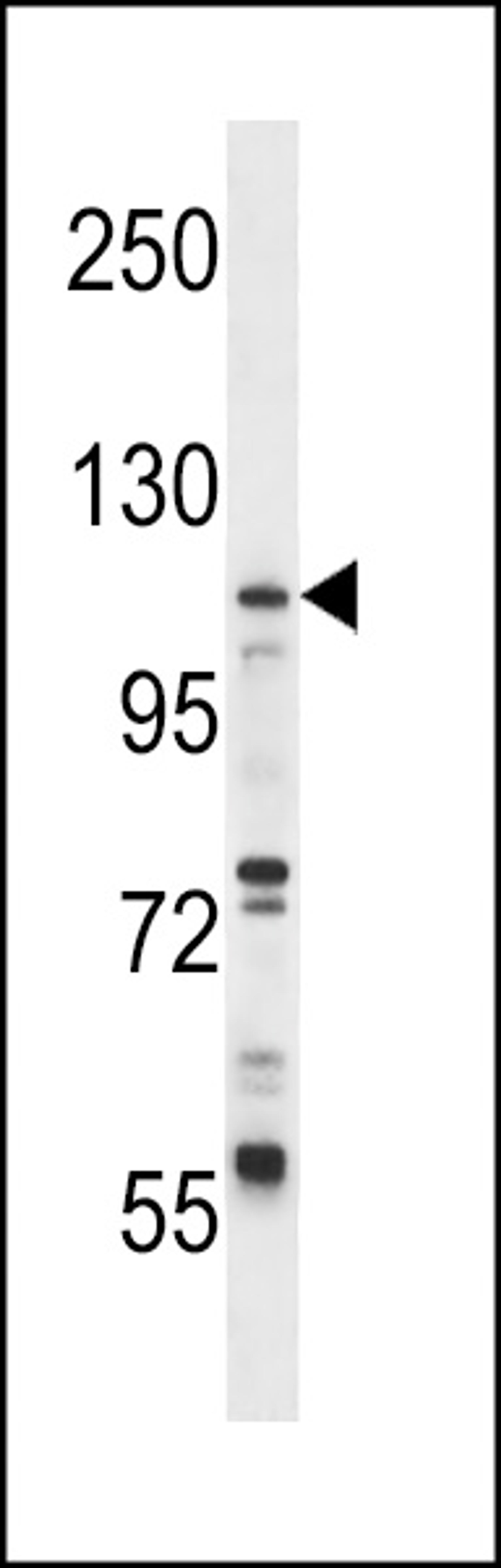 Western blot analysis in CEM cell line lysates (35ug/lane).