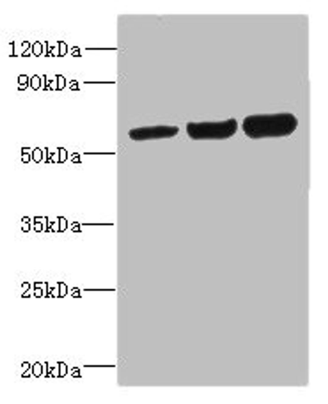 Western blot. All lanes: OSBPL2 antibody at 1ug/ml. Lane 1: HepG2 whole cell lysate. Lane 2: Mouse heart tissue. Lane 3: Hela whole cell lysate. Secondary. Goat polyclonal to rabbit IgG at 1/10000 dilution. Predicted band size: 56, 54 kDa. Observed band size: 56 kDa. 
