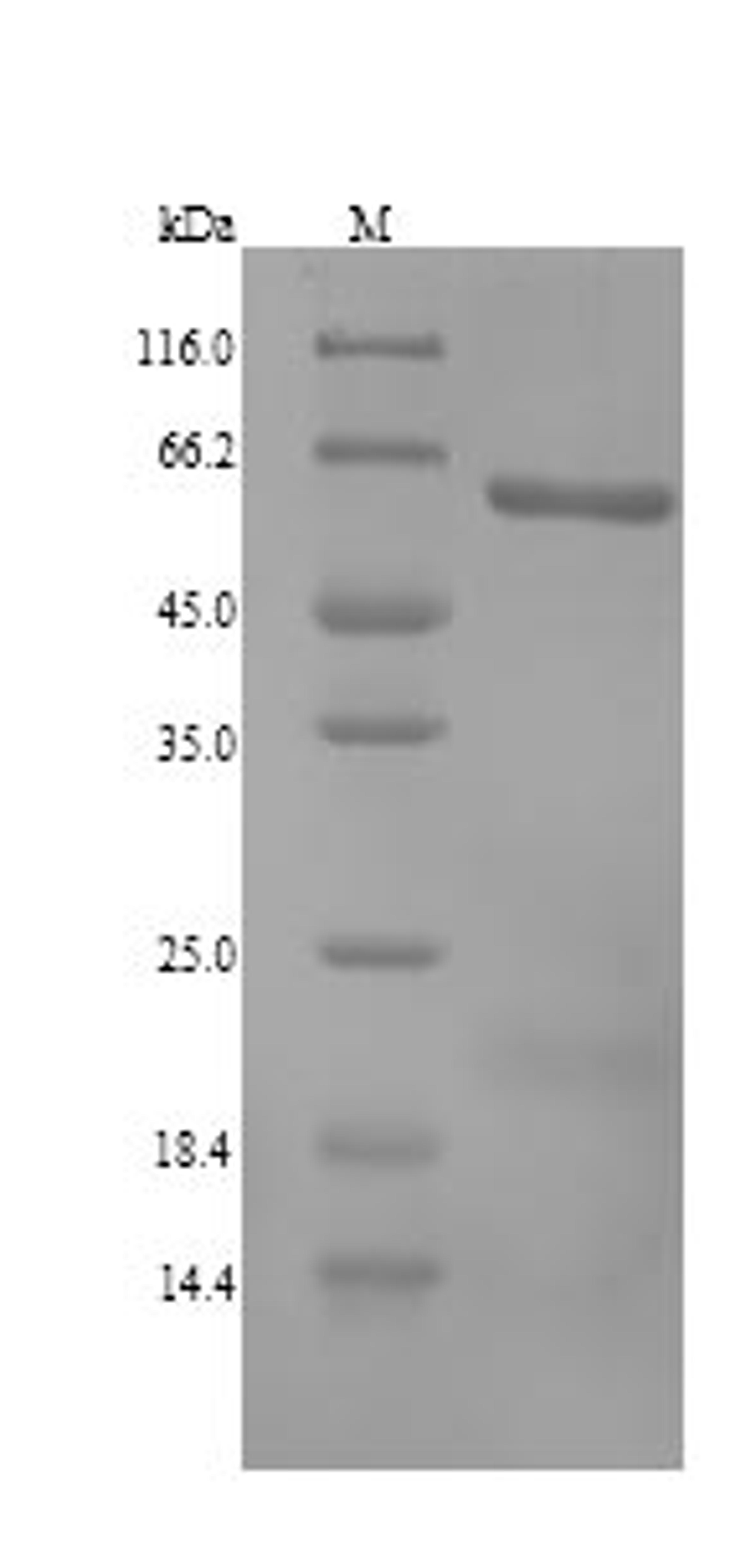 (Tris-Glycine gel) Discontinuous SDS-PAGE (reduced) with 5% enrichment gel and 15% separation gel.