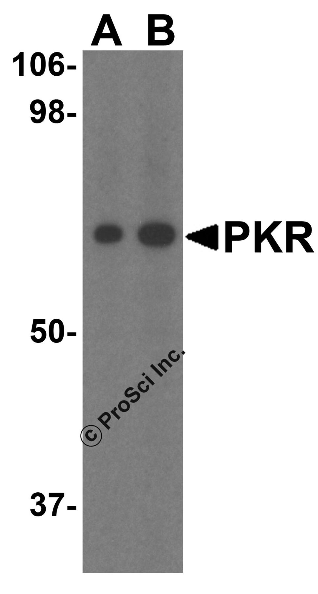 <strong>Figure 1 Western Blot Validation of PKR in MCF-7 Cells </strong><br>
Loading: 15 &#956;g of lysates per lane.
Antibodies: PKR 3949 (A: 1 &#956;g/mL; B: 2 µg/mL), 1h incubation at RT in 5% NFDM/TBST.
Secondary: Goat anti-rabbit IgG HRP conjugate at