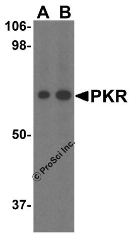 <strong>Figure 1 Western Blot Validation of PKR in MCF-7 Cells </strong><br>
Loading: 15 μg of lysates per lane.
Antibodies: PKR 3949 (A: 1 μg/mL; B: 2 µg/mL), 1h incubation at RT in 5% NFDM/TBST.
Secondary: Goat anti-rabbit IgG HRP conjugate at