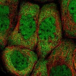 Immunocytochemistry: PCBP2 Antibody [NBP1-83241] - Immunofluorescence:  [NBP1-83241] - Staining of human cell line A-431 shows positivity in nucleus but not nucleoli & cytoplasm.