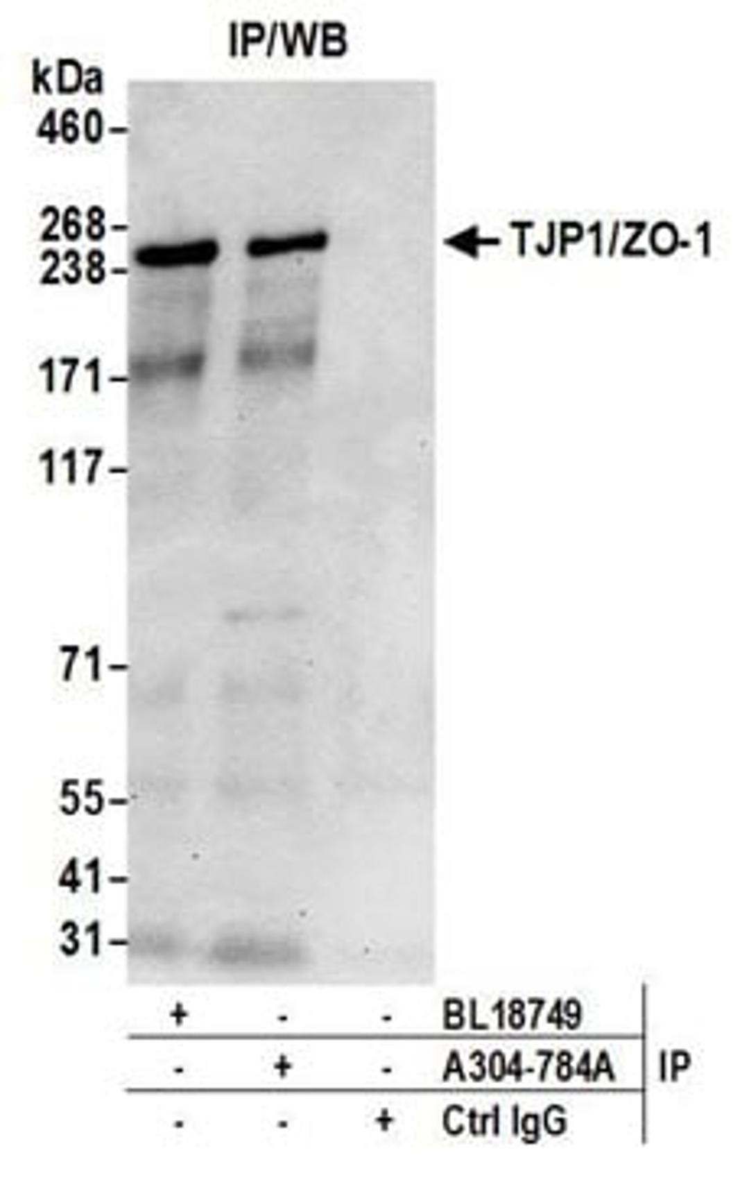 Detection of human TJP1/ZO-1 by western blot of immunoprecipitates.