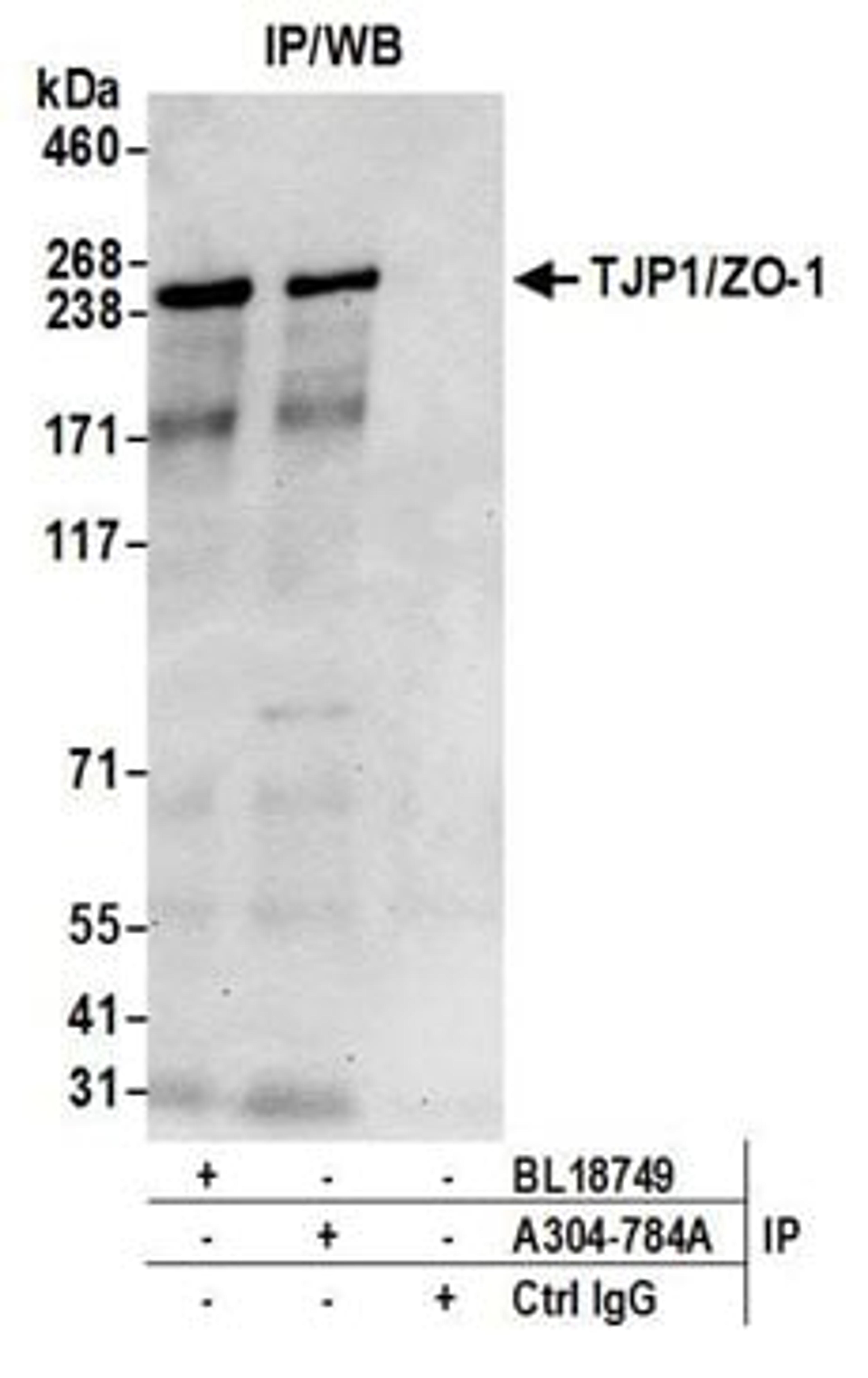 Detection of human TJP1/ZO-1 by western blot of immunoprecipitates.