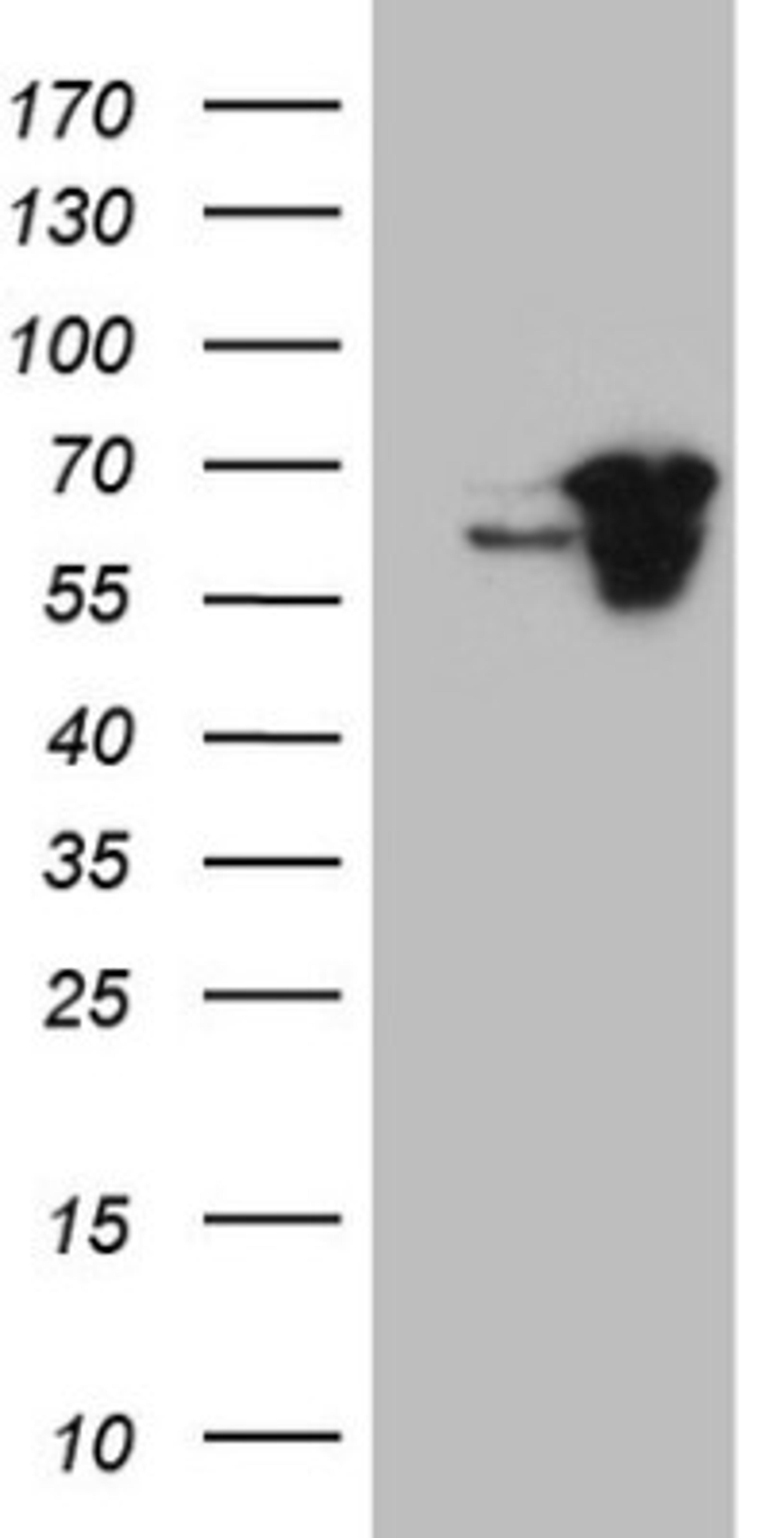 Western Blot: SDCCAG10 Antibody (4C8) [NBP2-46409] - Analysis of HEK293T cells were transfected with the pCMV6-ENTRY control (Left lane) or pCMV6-ENTRY SDCCAG10.