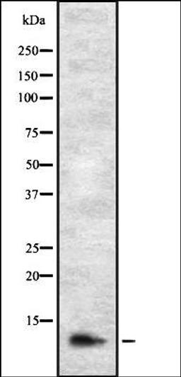 Western blot analysis of HEK293 cells using DIRC1 antibody