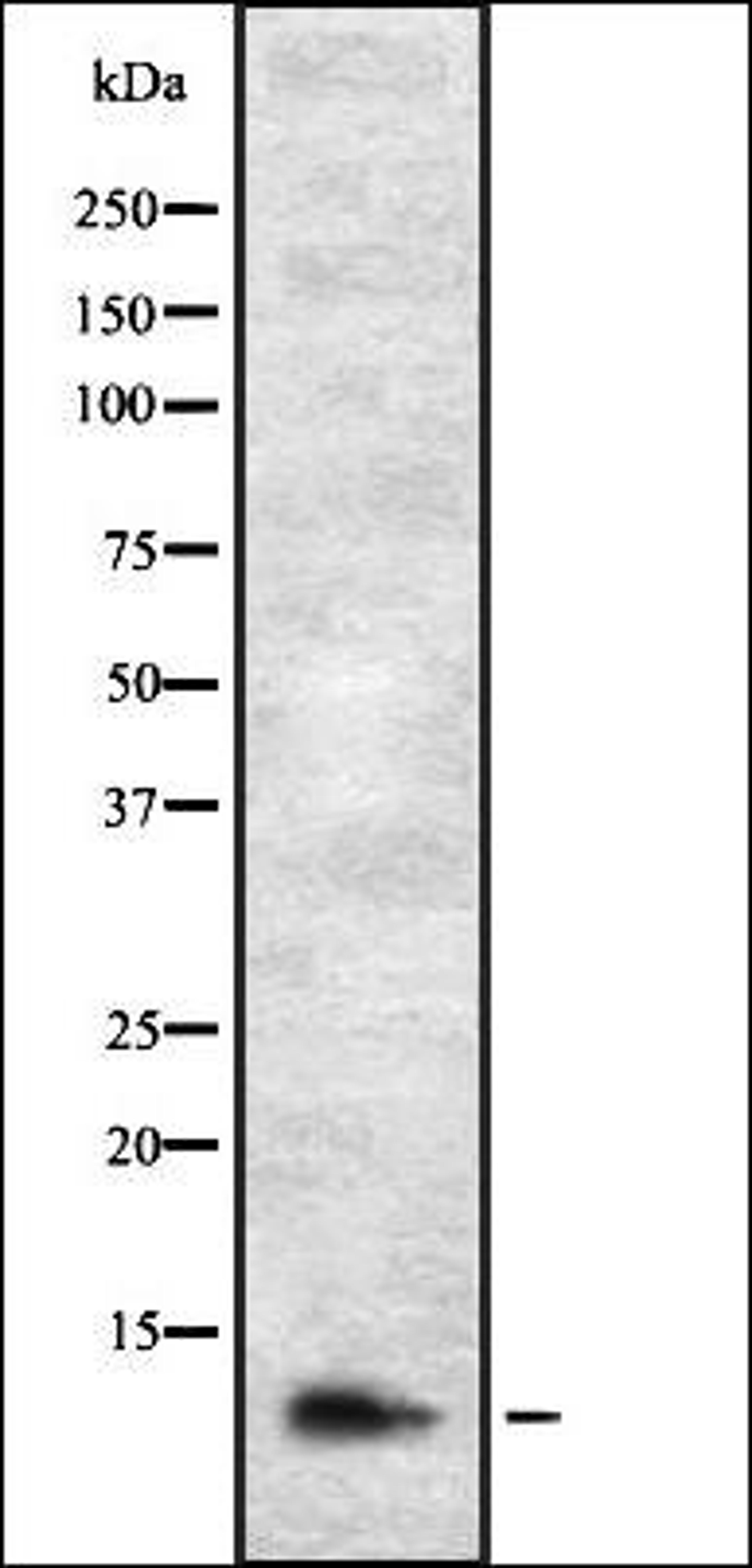 Western blot analysis of HEK293 cells using DIRC1 antibody