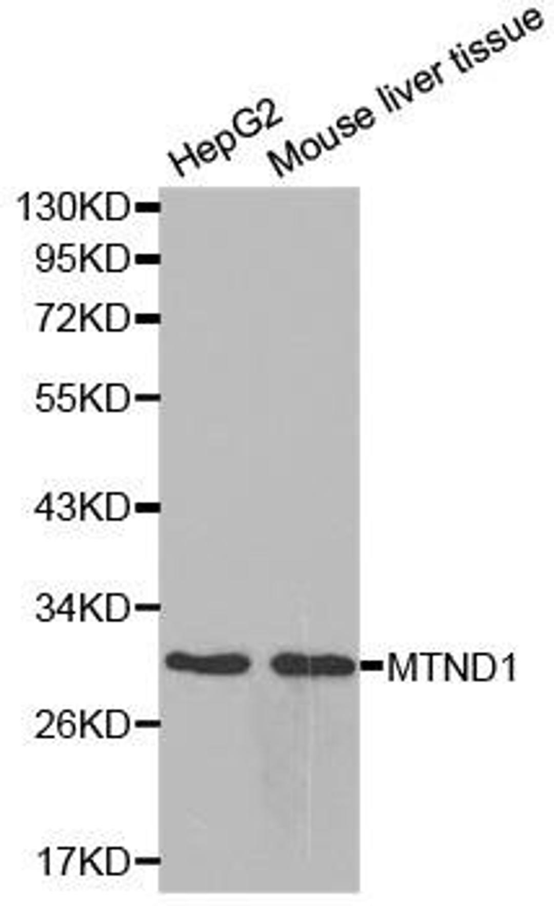 Western blot analysis of extracts of various cells using MTND1 antibody