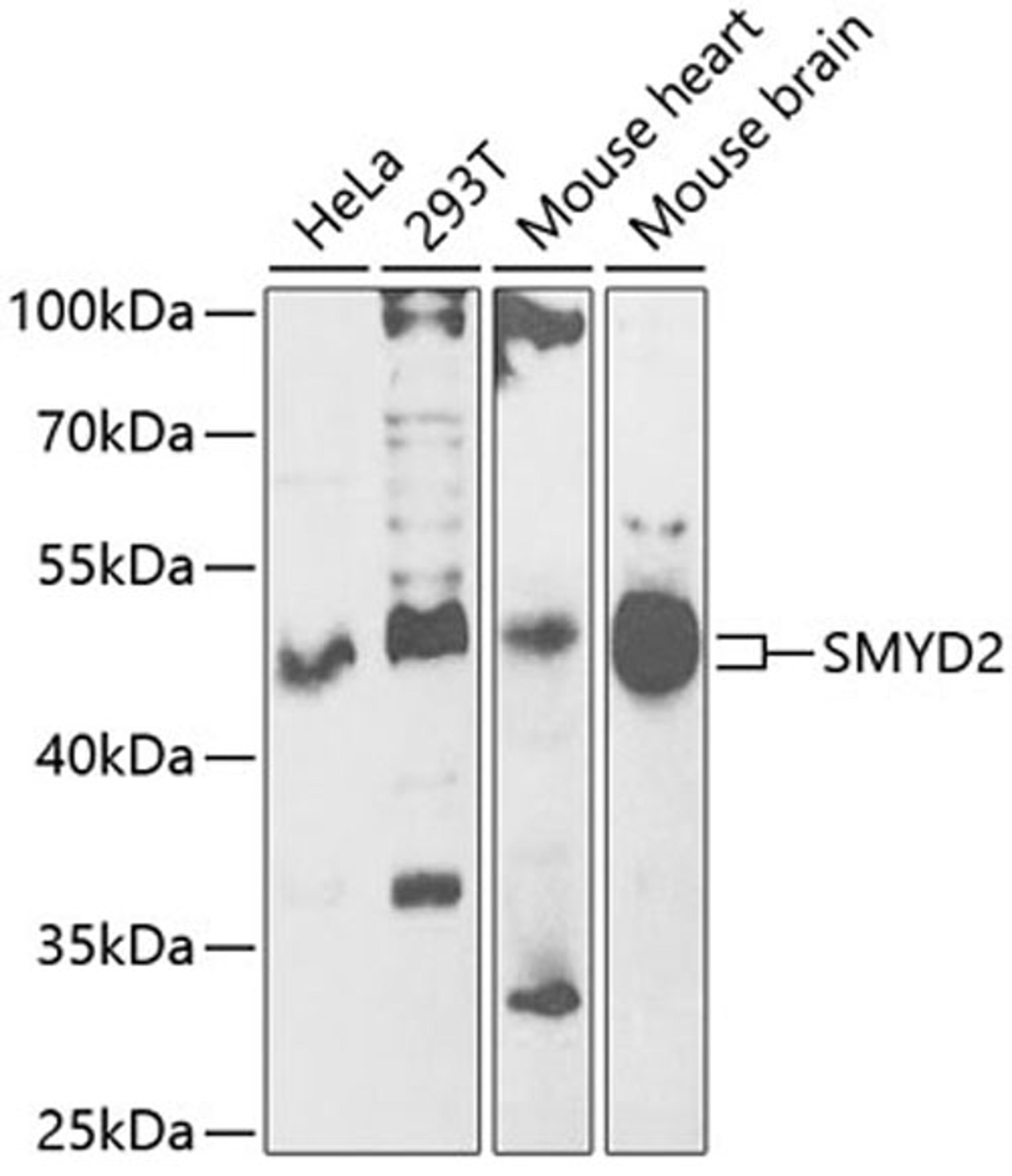 Western blot - SMYD2 antibody (A6474)