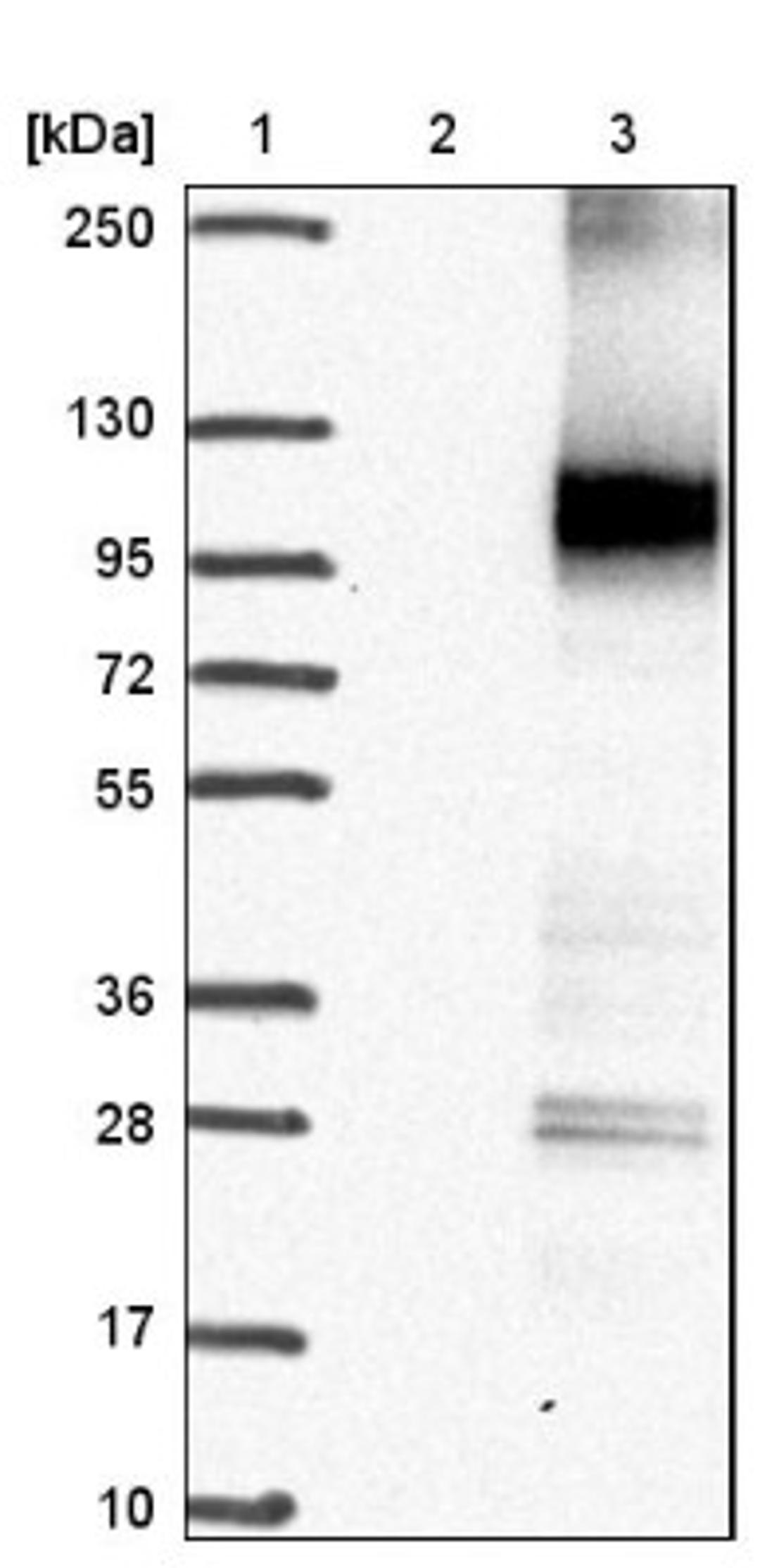 Western Blot: ATP12A Antibody [NBP1-88886] - Lane 1: Marker [kDa] 250, 130, 95, 72, 55, 36, 28, 17, 10<br/>Lane 2: Negative control (vector only transfected HEK293T lysate)<br/>Lane 3: Over-expression lysate (Co-expressed with a C-terminal myc-DDK tag (~3.1 kDa) in mammalian HEK293T cells, LY400633)