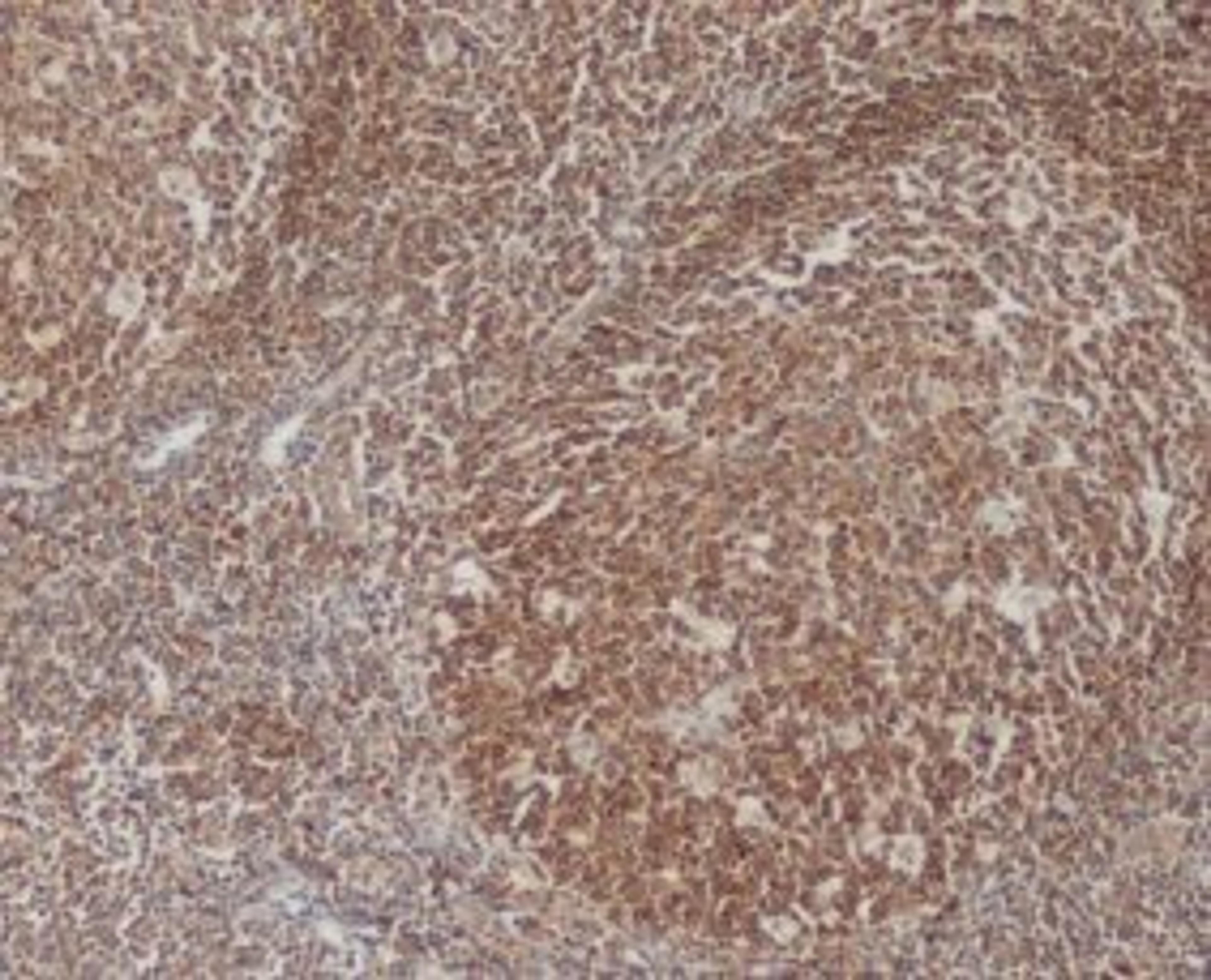 Staining of paraffin embedded human tonsil with Mouse anti Human Bcl-10 