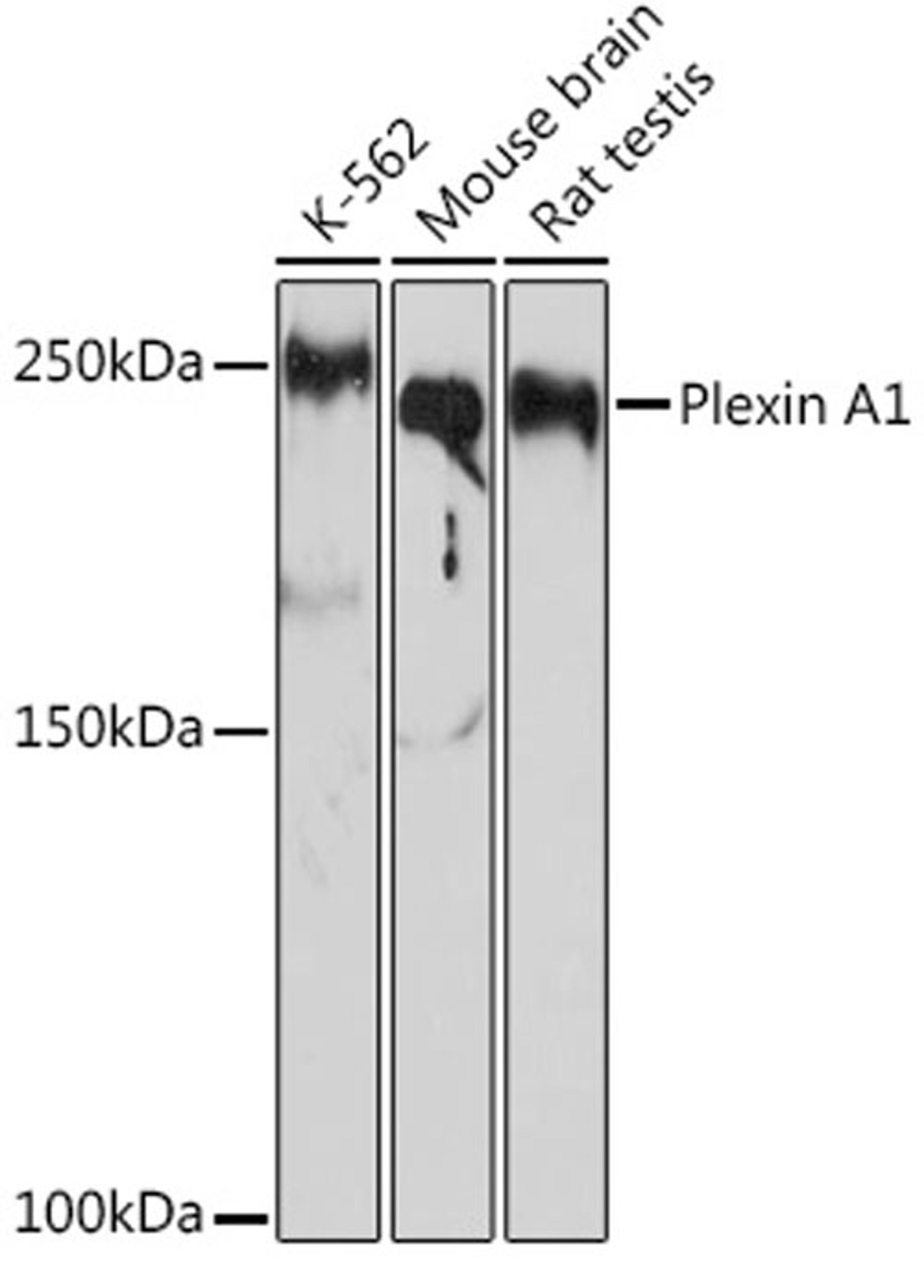 Western blot - Plexin A1 Rabbit mAb (A3698)
