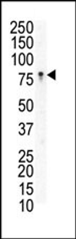 Western blot analysis of anti-EphB3 N-term Pab in Jurkat cell lysate