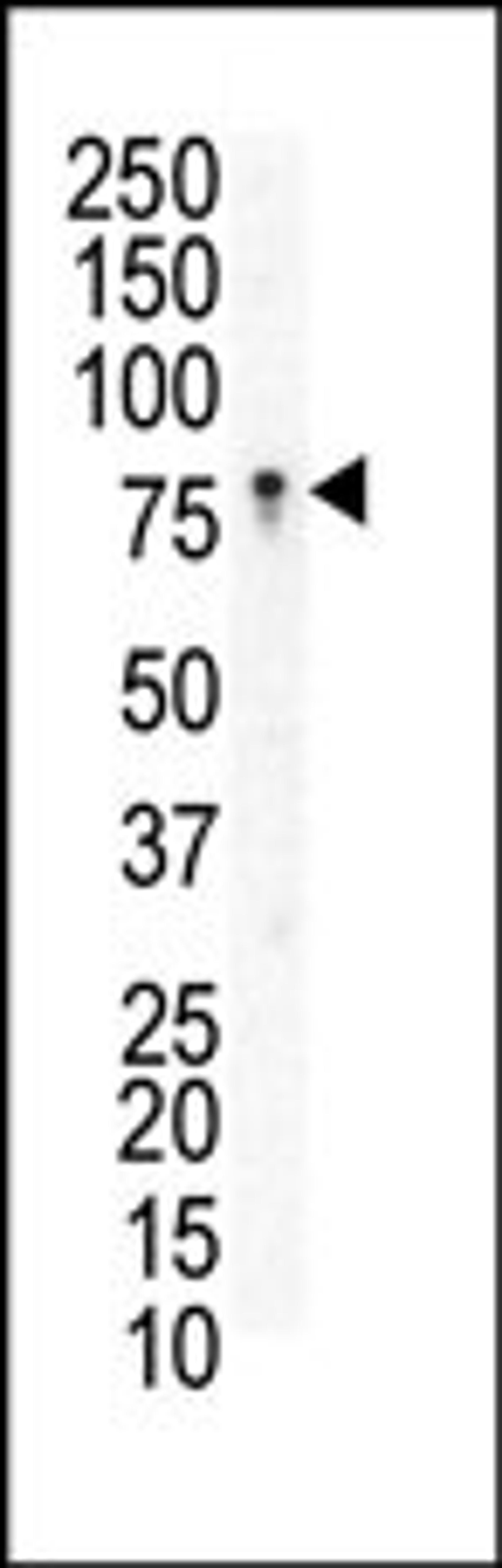 Western blot analysis of anti-EphB3 N-term Pab in Jurkat cell lysate