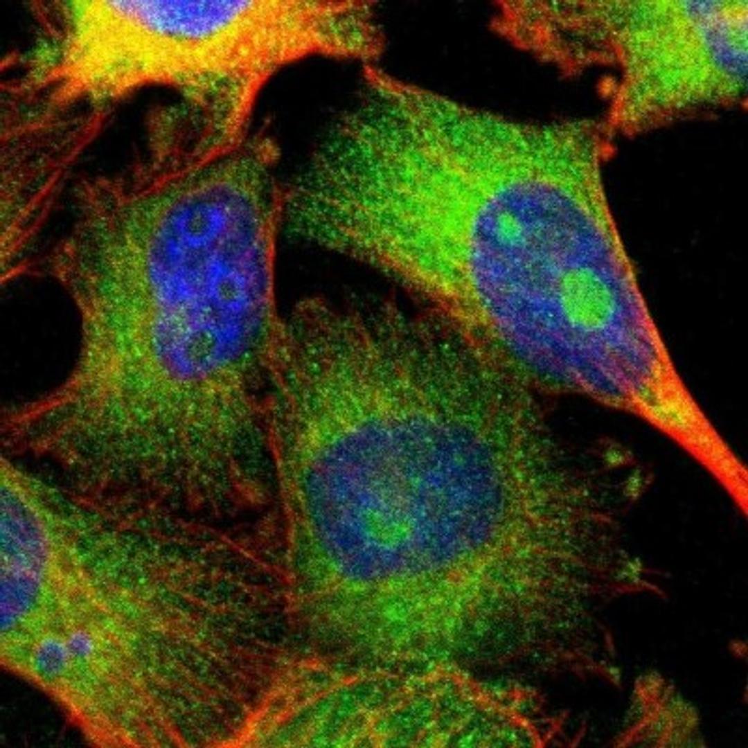 Immunocytochemistry/Immunofluorescence: Testis expressed 264 Antibody [NBP1-89866] - Staining of human cell line U-251MG shows positivity in nucleoli & cytoplasm.