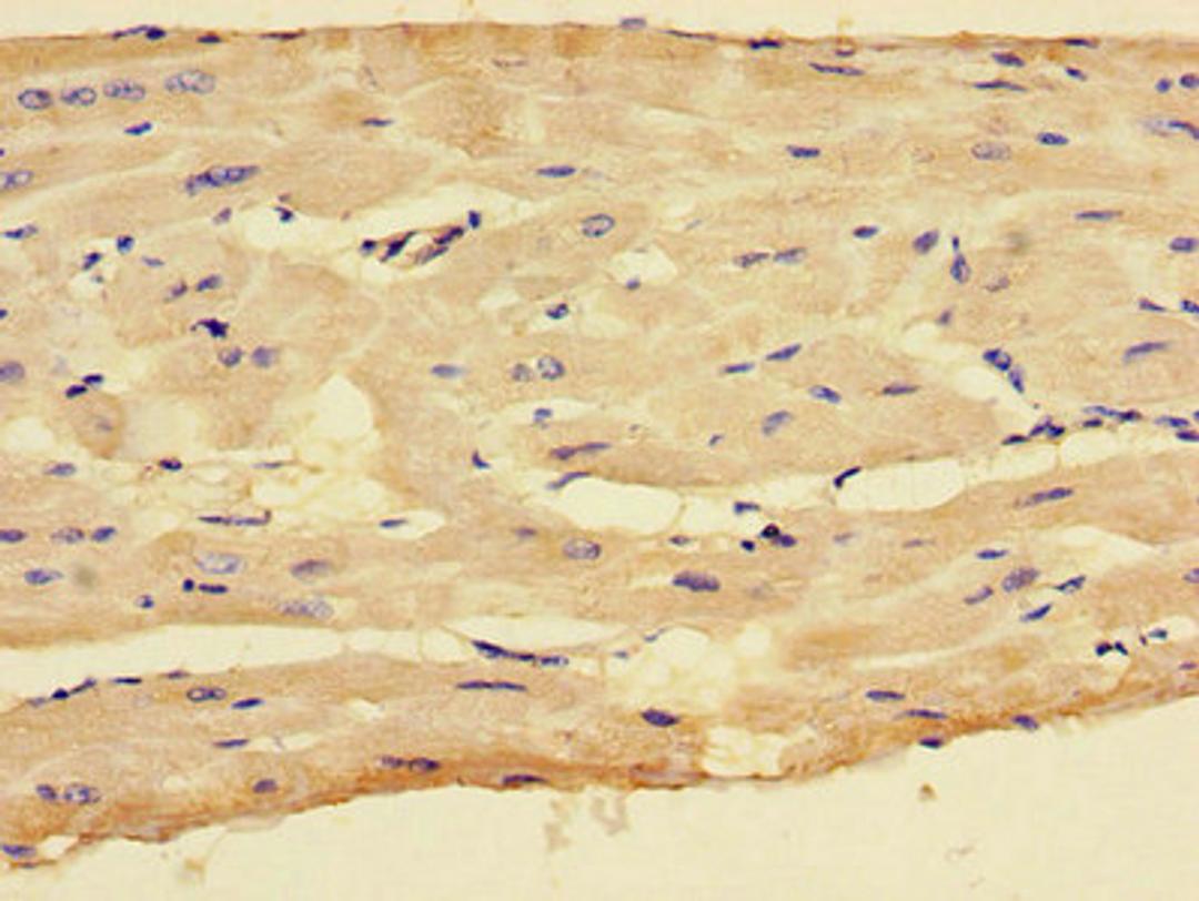 Immunohistochemistry of paraffin-embedded human heart tissue using CSB-PA006236LA01HU at dilution of 1:100