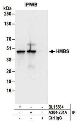 Detection of human HMBS by western blot of immunoprecipitates.