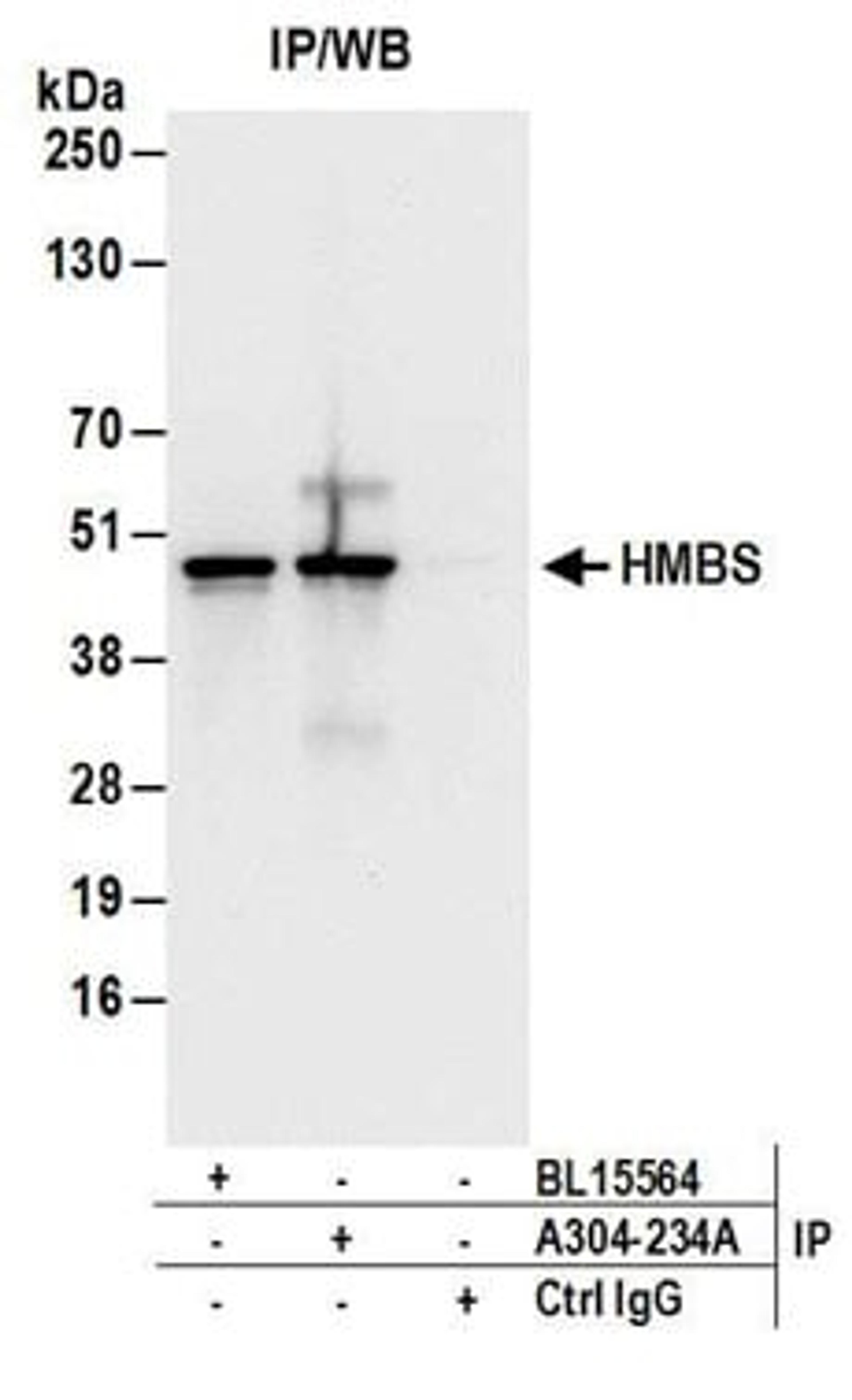 Detection of human HMBS by western blot of immunoprecipitates.