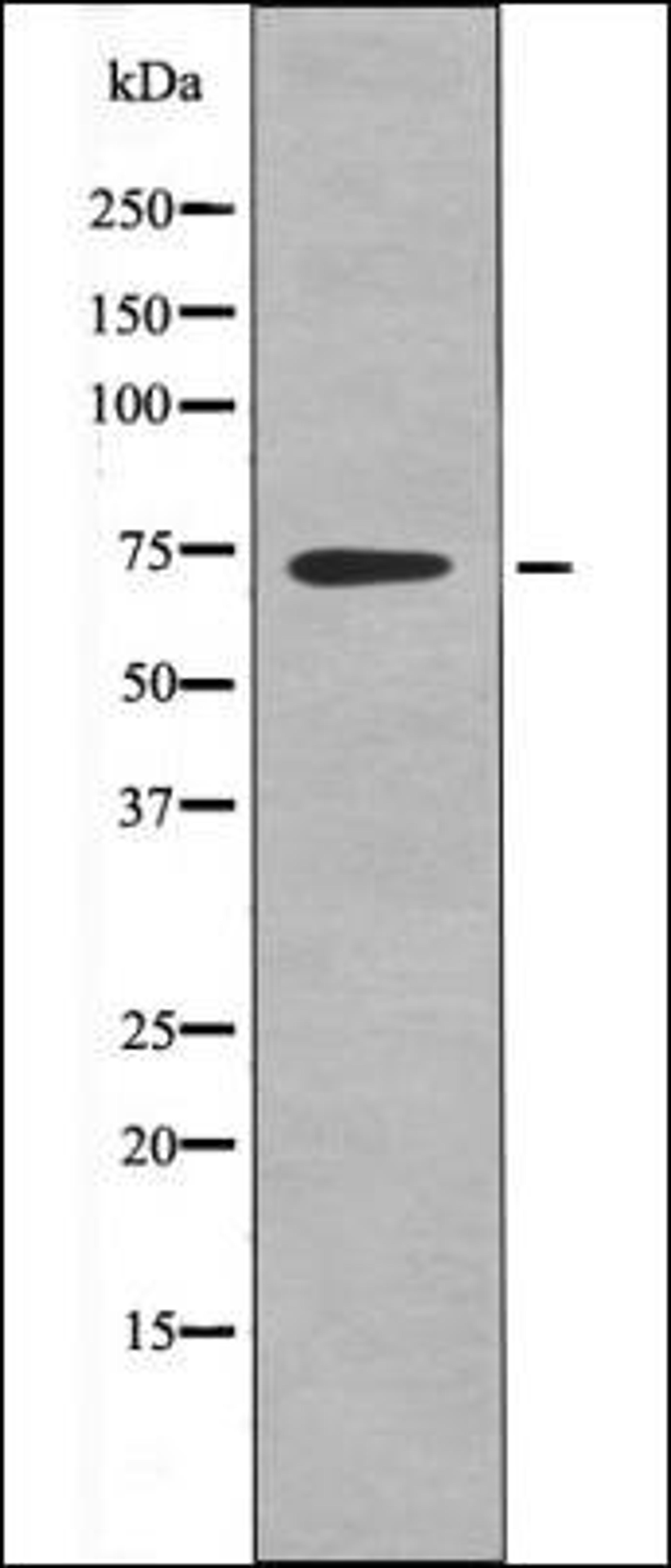 Western blot analysis of EGF treated K562 whole cell lysates using DYRK1A/B -Phospho-Tyr321/273- antibody