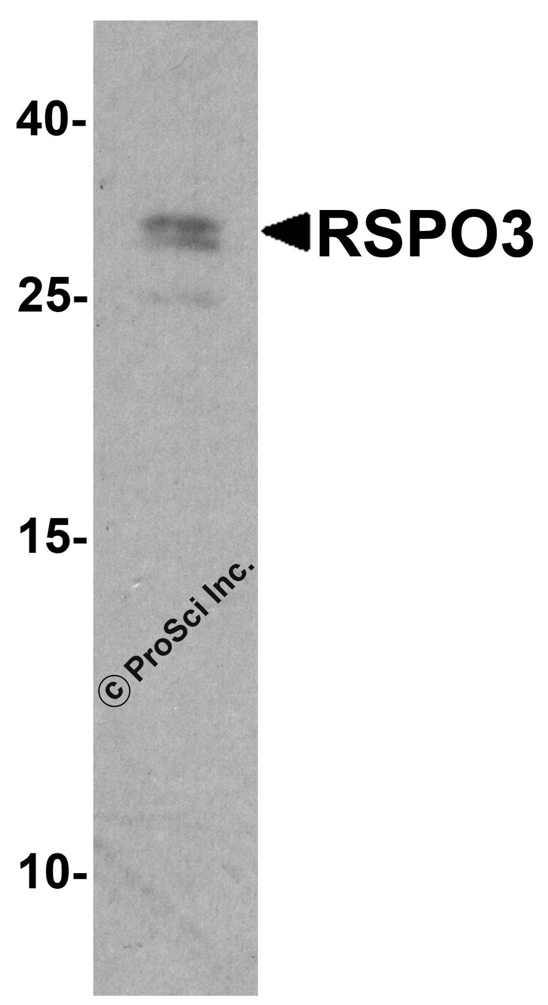 Western blot analysis of RSPO3 in 293 cell lysate with RSPO3 antibody at 1 μg/ml.