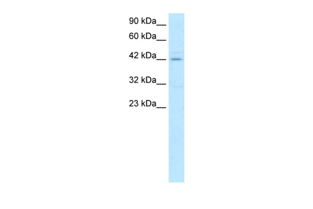 Antibody used in WB on Human Jurkat 0.5 ug/ml.