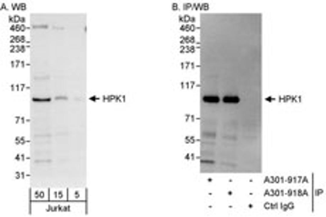 Detection of human HPK1 by western blot and immunoprecipitation.