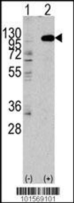 Western blot analysis of anti-hFGFR2-C808 Pab in 293 cell line lysates transiently transfected with the FGFR2 gene (2ug/lane)