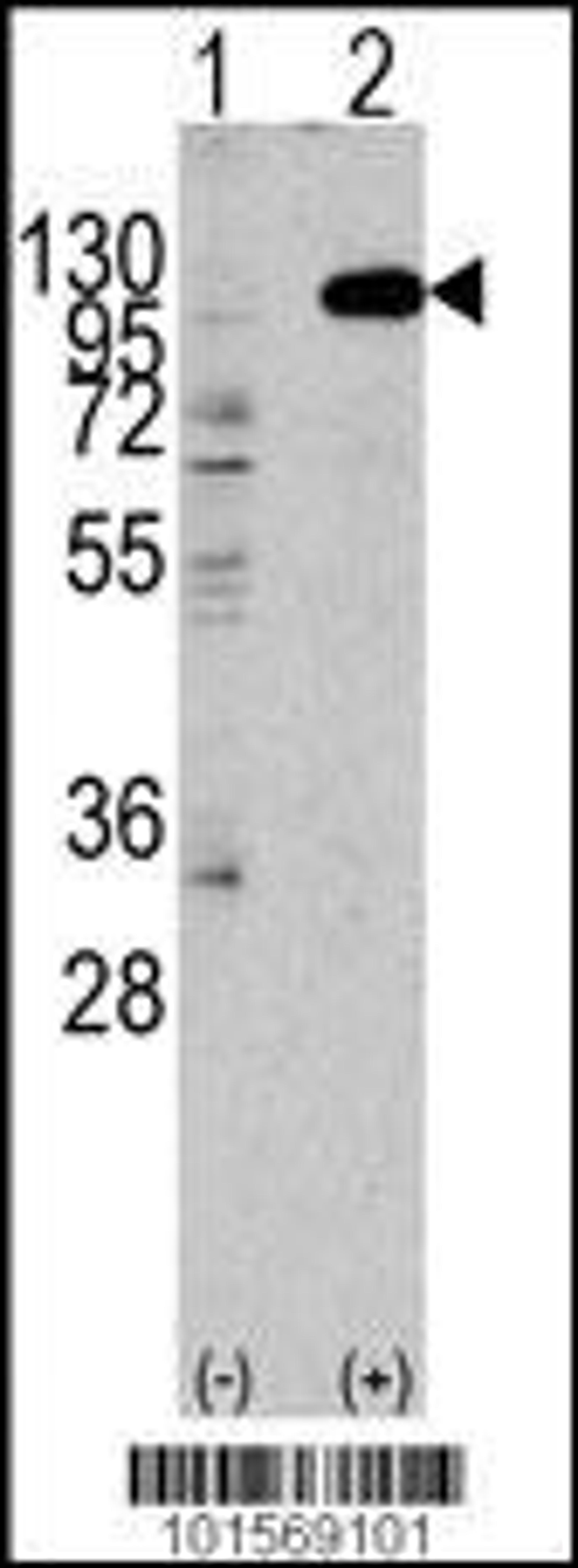 Western blot analysis of anti-hFGFR2-C808 Pab in 293 cell line lysates transiently transfected with the FGFR2 gene (2ug/lane)