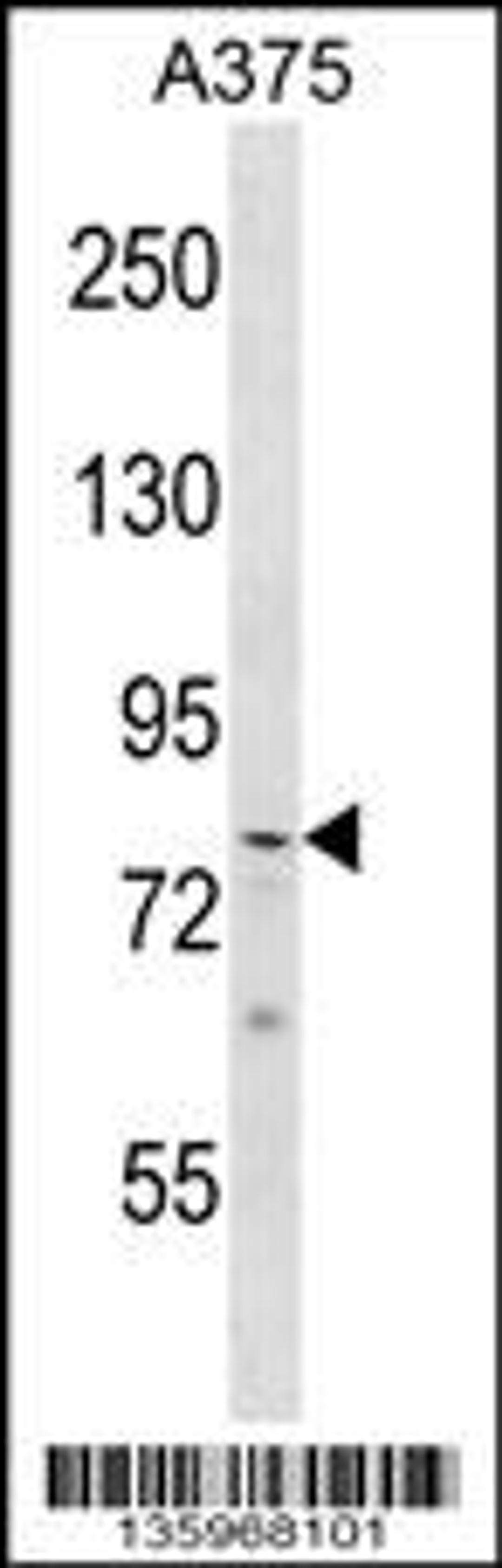 Western blot analysis in A375 cell line lysates (35ug/lane).