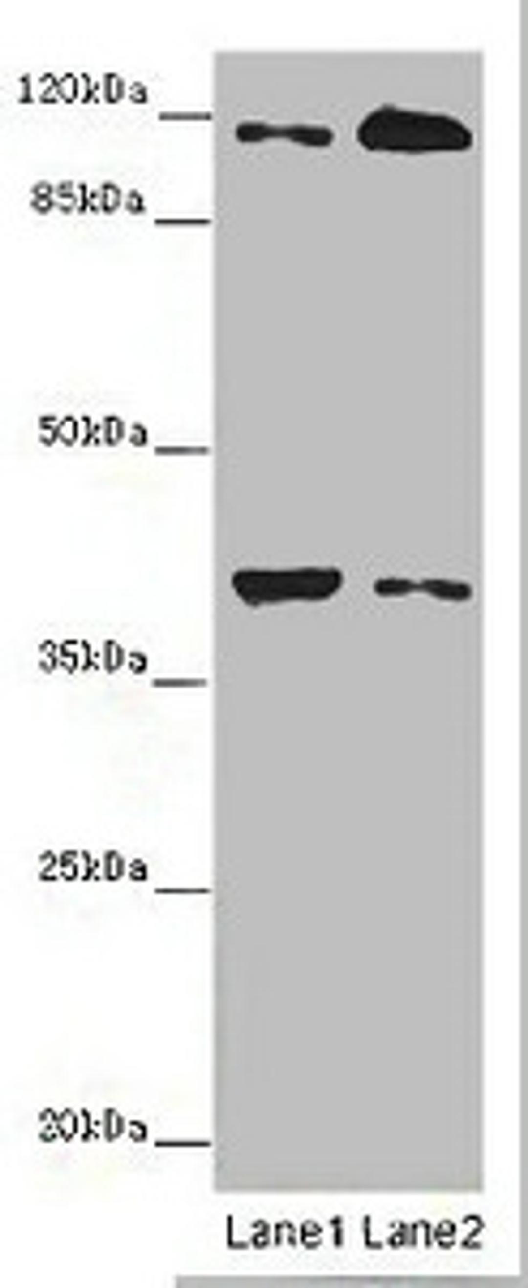 Western blot. All lanes: MILR1 antibody at 14 ug/ml. Lane 1: Mouse brain tissue. Lane 2: HepG2 whole cell lysate. Secondary. Goat polyclonal to rabbit IgG at 1/10000 dilution. Predicted band size: 39, 28, 29 kDa. Observed band size: 39, 120 kDa. 