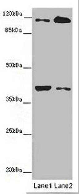 Western blot. All lanes: MILR1 antibody at 14 ug/ml. Lane 1: Mouse brain tissue. Lane 2: HepG2 whole cell lysate. Secondary. Goat polyclonal to rabbit IgG at 1/10000 dilution. Predicted band size: 39, 28, 29 kDa. Observed band size: 39, 120 kDa. 